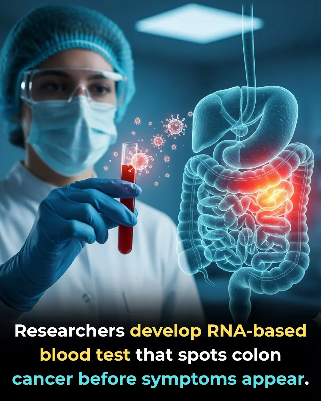 Breakthrough RNA-Based Blood Test Shows 95% Accuracy in Early-Stage Colon Cancer Detection