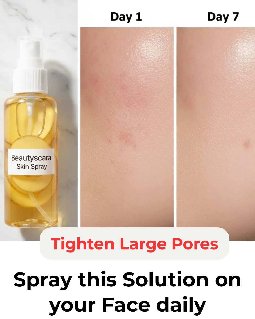 Potato Toner for Face – Dark Spots, Clear Skin & Pigmentation