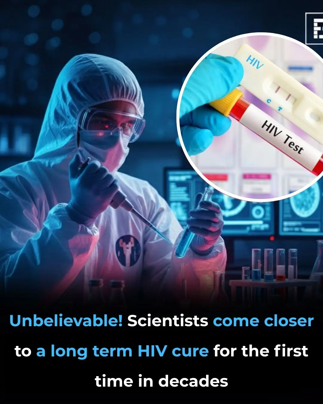 Promising Signs of a Potential Long-Term HIV Cure: A Breakthrough Study from UCSF