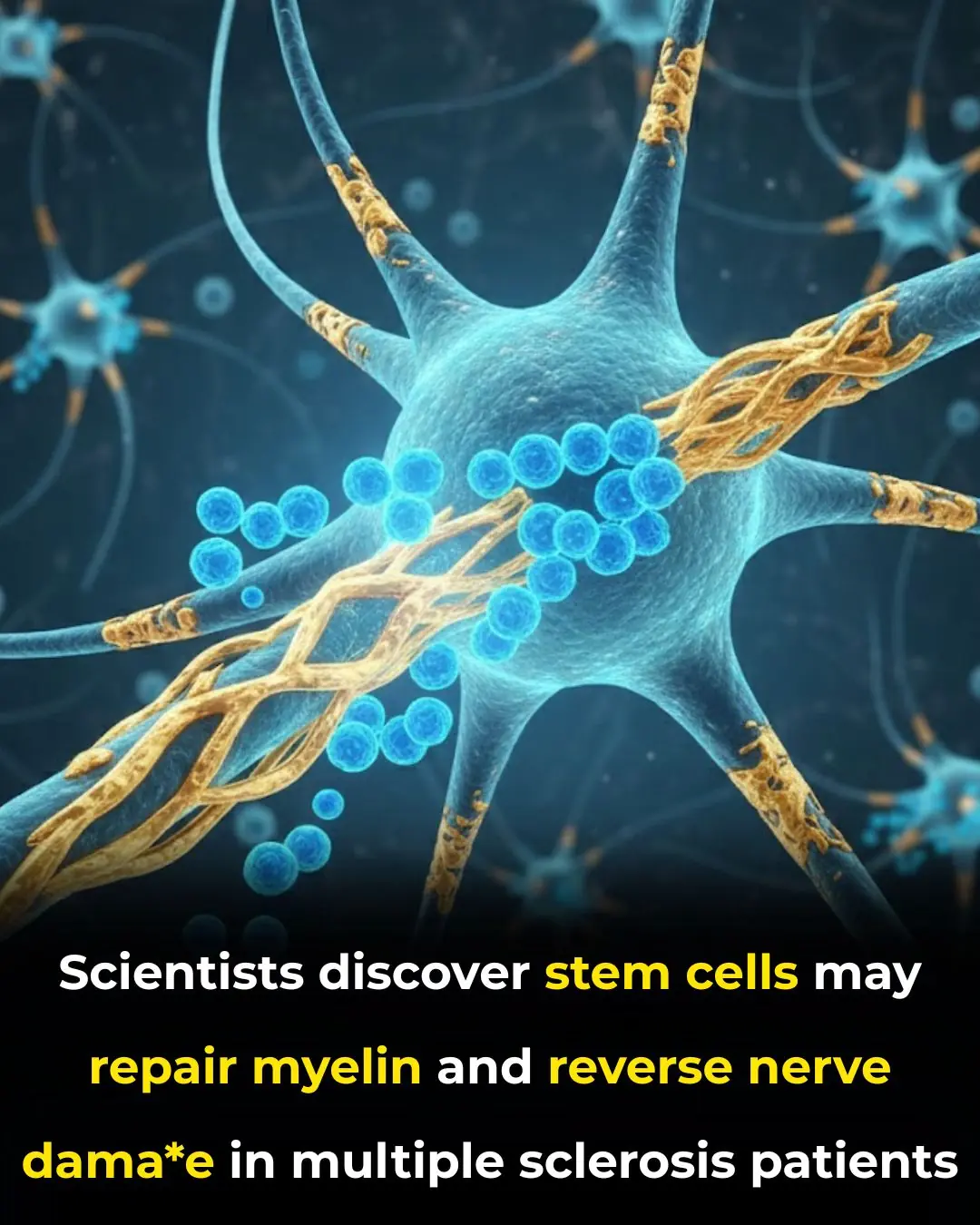Groundbreaking Stem Cell Discovery Offers Hope for Rebuilding Myelin and Reversing Nerve Damage in Multiple Sclerosis