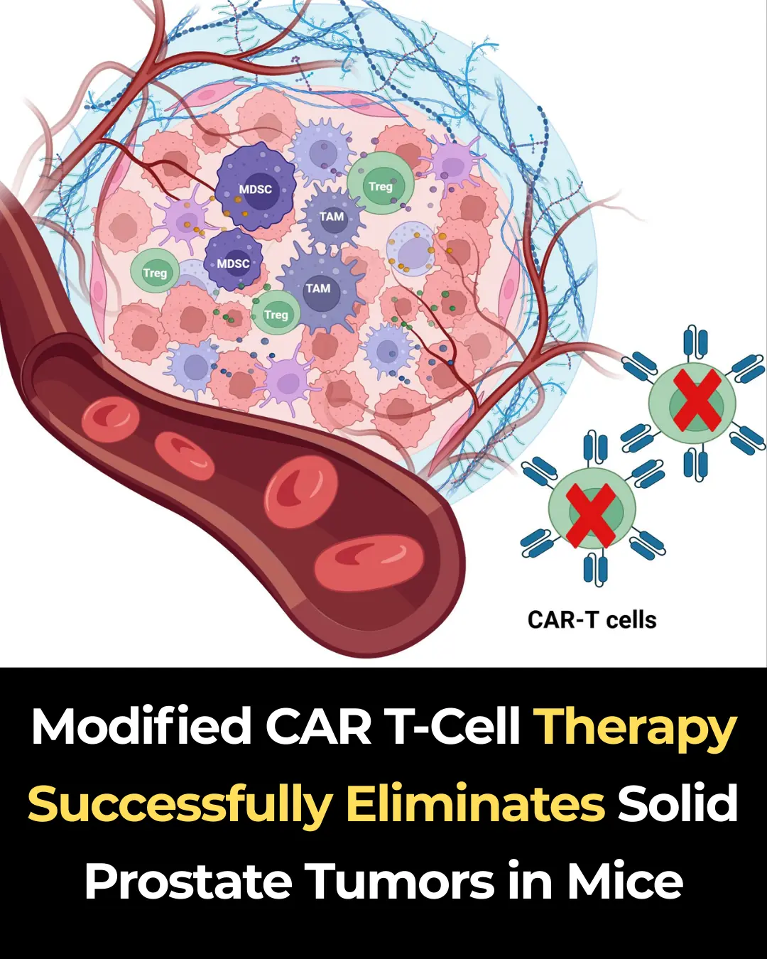 Modified CAR T-Cell Therapy Successfully Eliminates Solid Prostate Tumors in Mice