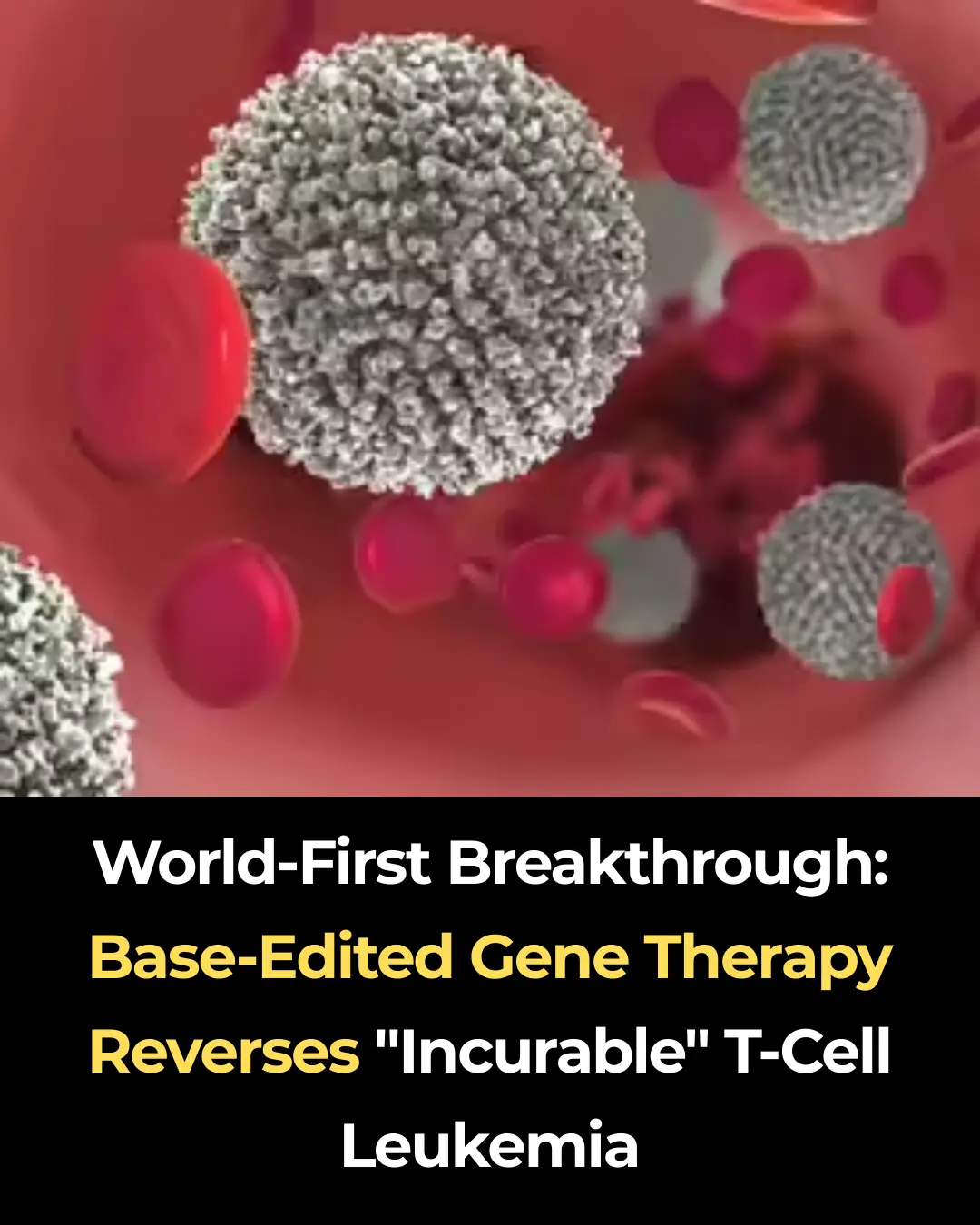 World-First Breakthrough: Base-Edited Gene Therapy Reverses "Incurable" T-Cell Leukemia