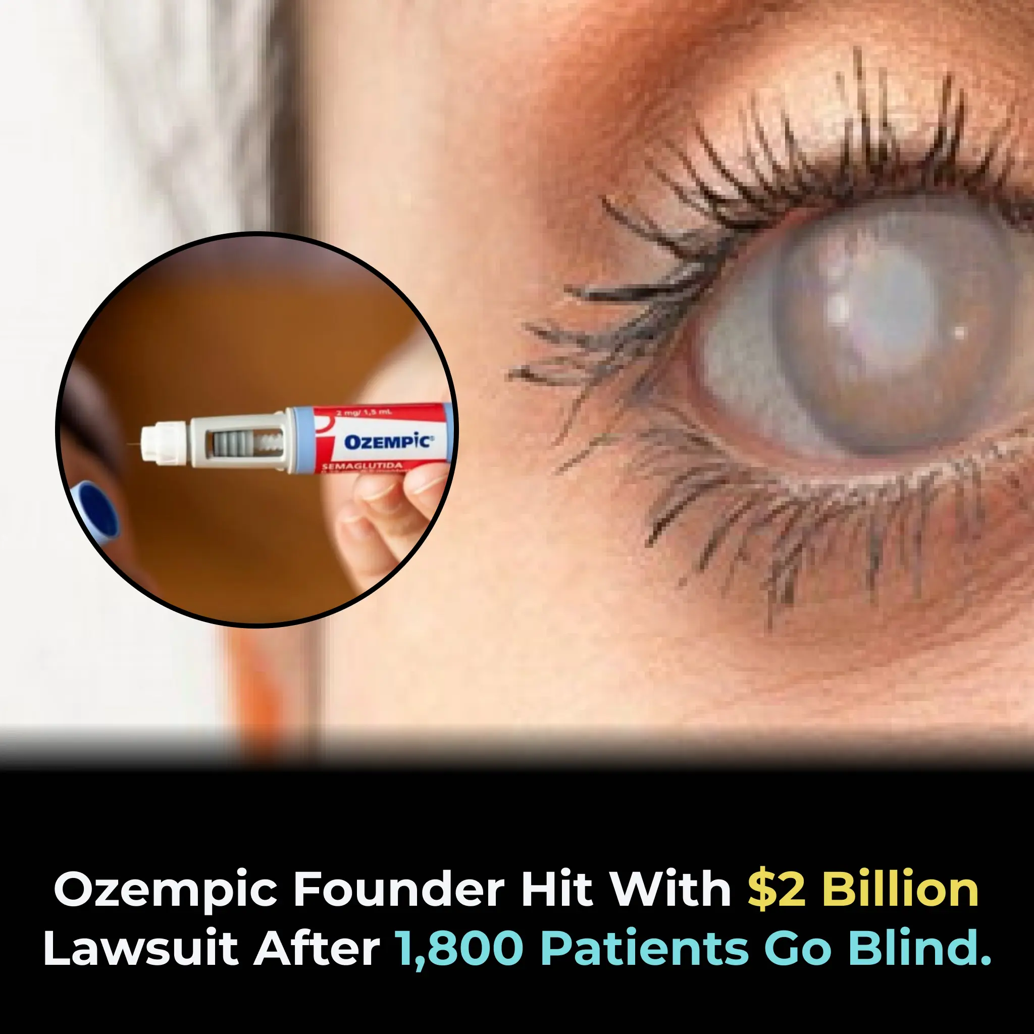 Over 1,800 Lawsuits Filed Against Ozempic, Alleging Severe Side Effects and Misleading Marketing