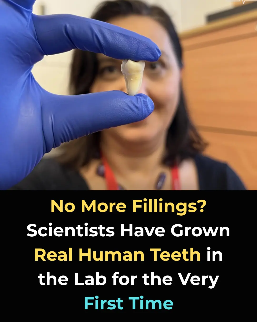 Breakthrough in Dentistry: Scientists Are Growing Living Teeth in the Lab—A Future Alternative to Fillings and Implants