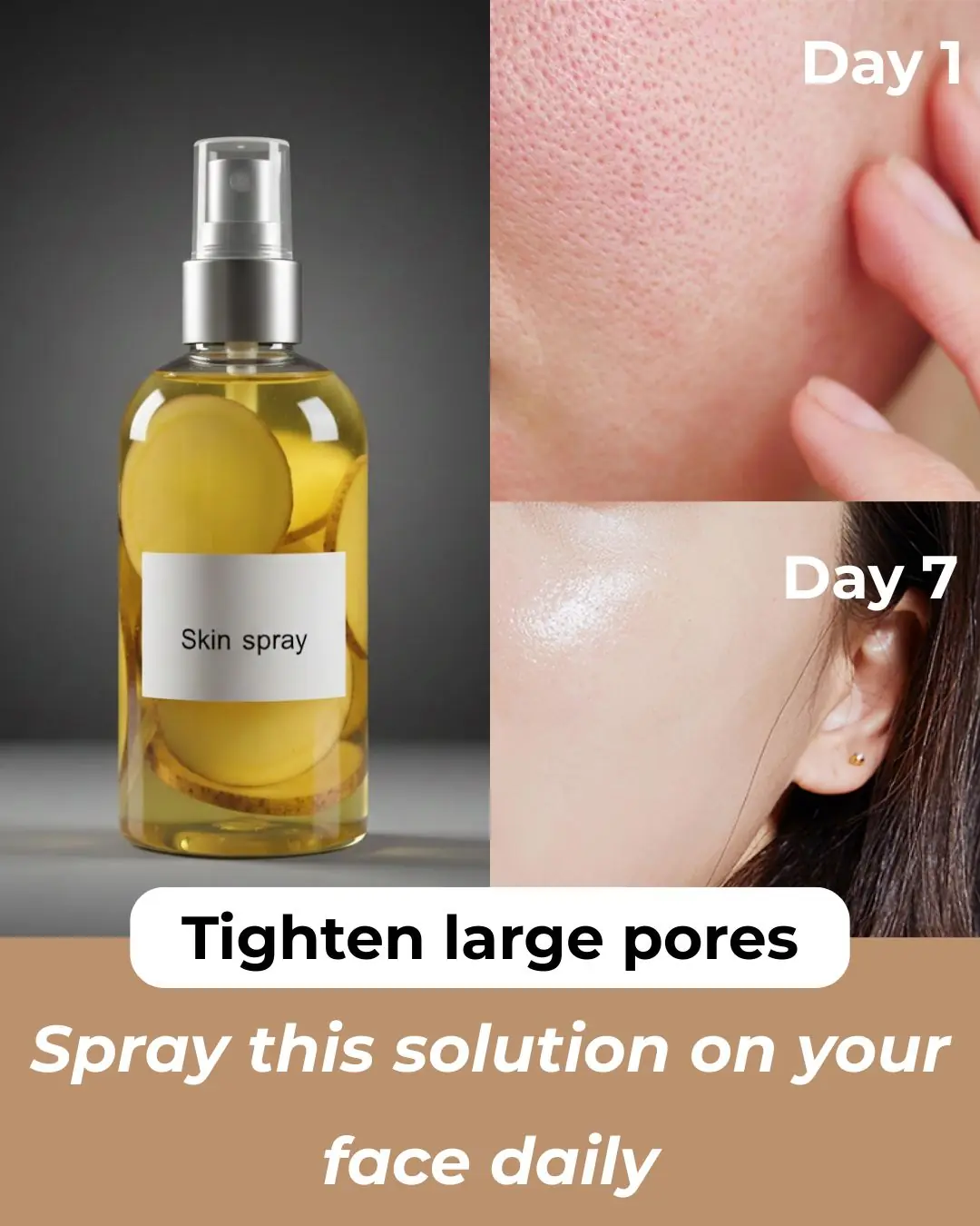 Potato Toner for Face – Dark Spots, Clear Skin & Pigmentation
