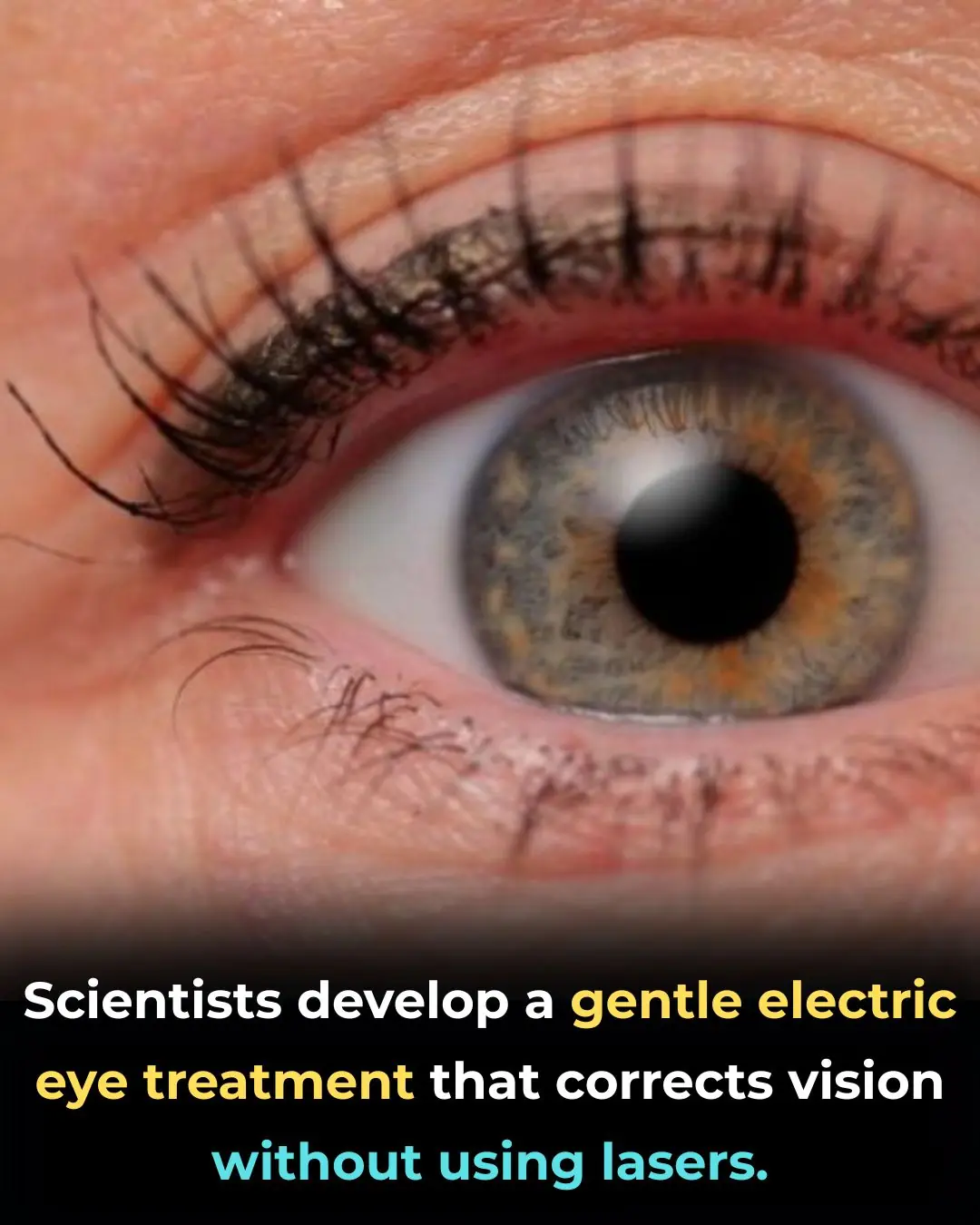 Electromechanical Reshaping: A New Non-Laser Approach to Vision Correction