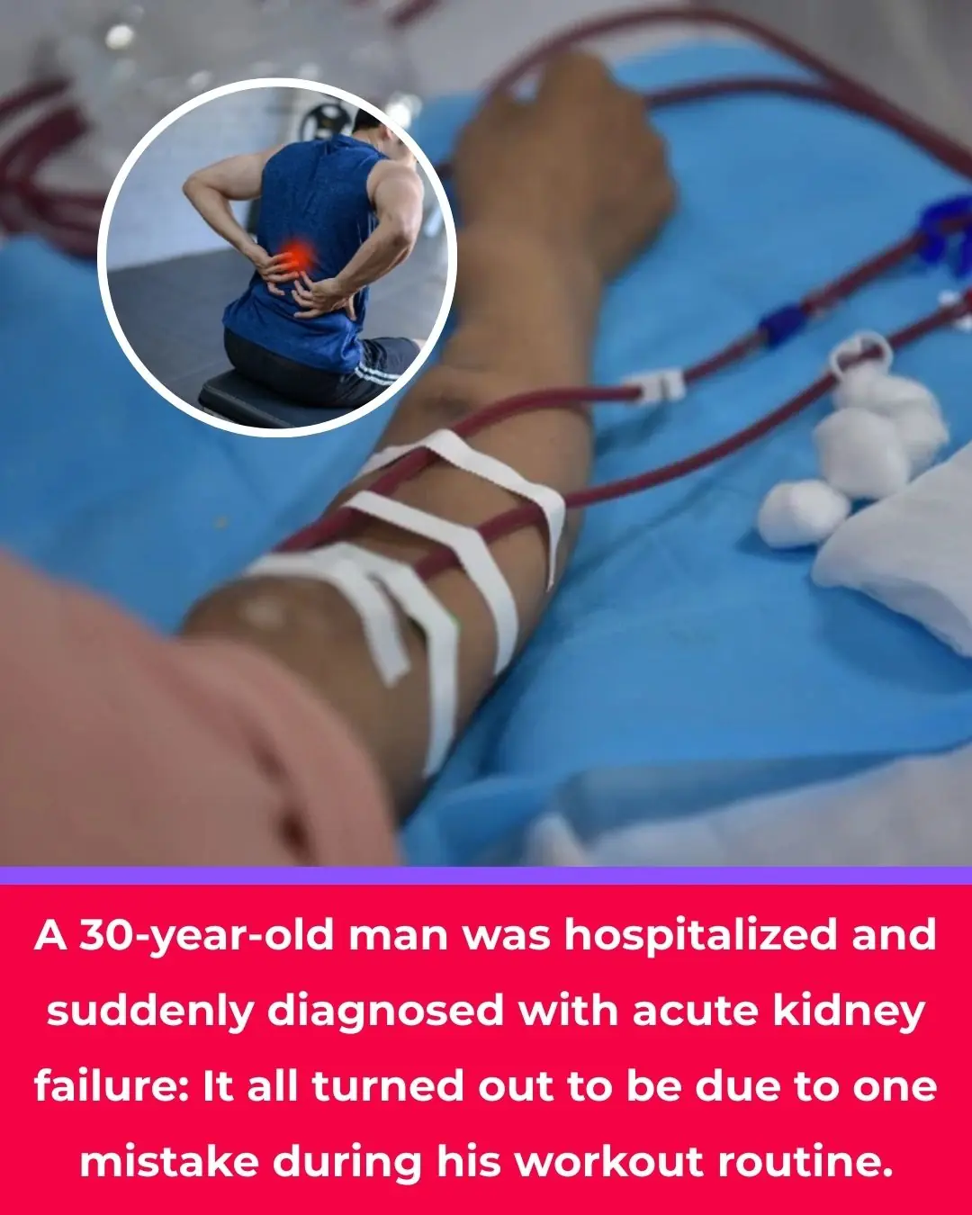 A 30-year-old man was hospitalized and suddenly diagnosed with acute kidney failure: It all turned out to be due to one mistake during his workout routine