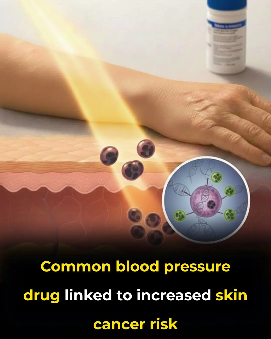 Common Blood Pressure Drug Hydrochlorothiazide Linked to Higher Skin Cancer Risk, New Studies Warn