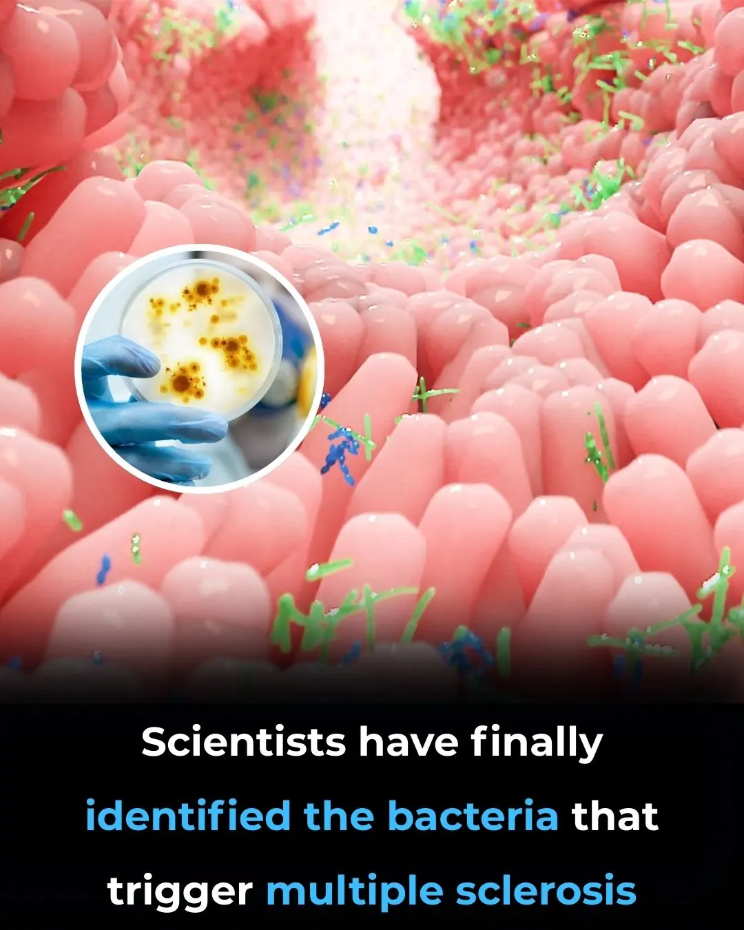 Scientists Have Finally Identified the Bacteria That Trigger Multiple Sclerosis
