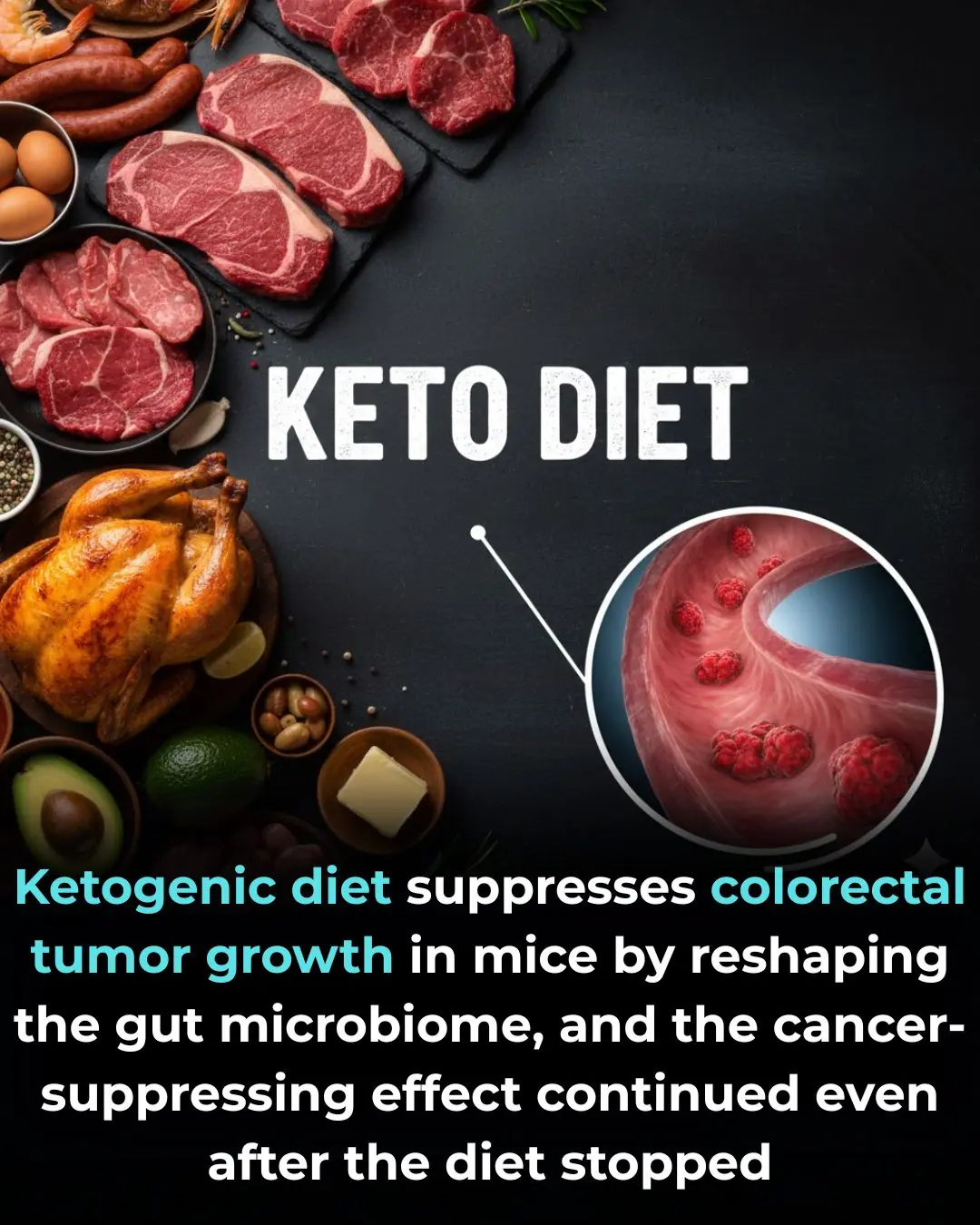 The Impact of Ketogenic Diet on Colorectal Cancer: Microbiome Reshaping and Long-term Suppression