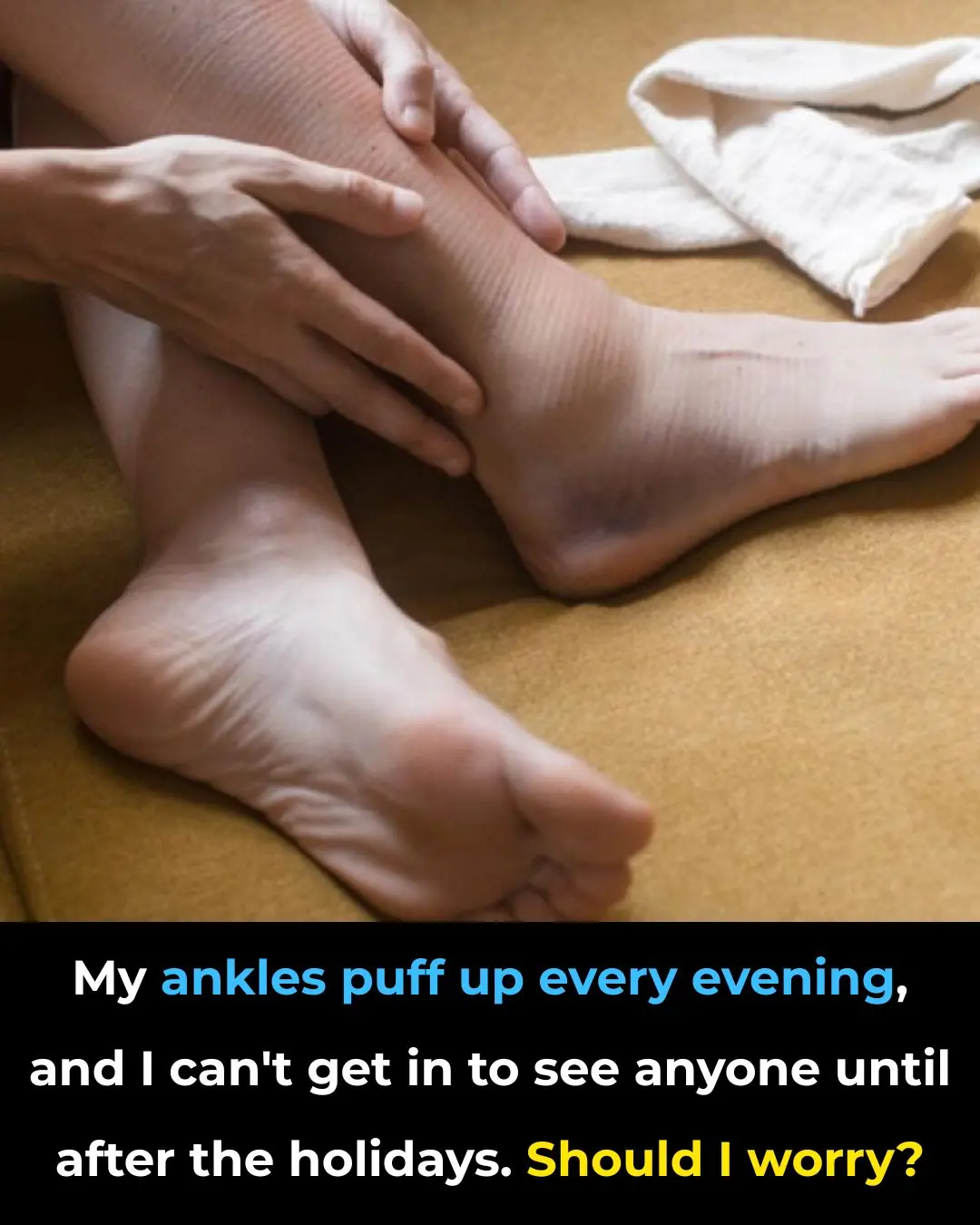 My ankles puff up every evening, and I can’t get in to see anyone until after the holidays. Should I worry?