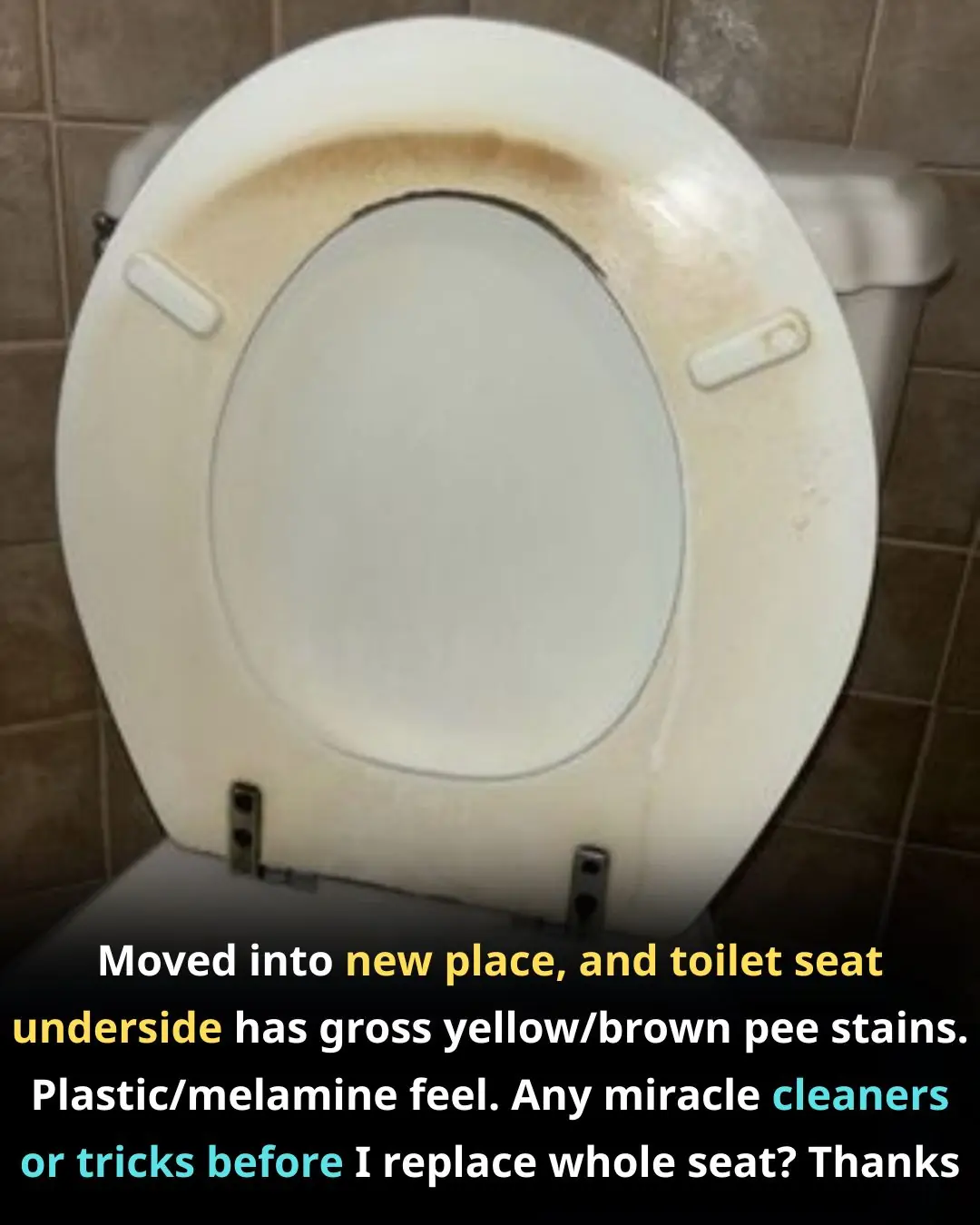 Moved into new place, and toilet seat underside has gross yellow/brown pee stains. Plastic/melamine feel. Any miracle cleaners or tricks before I replace whole seat? Thanks!