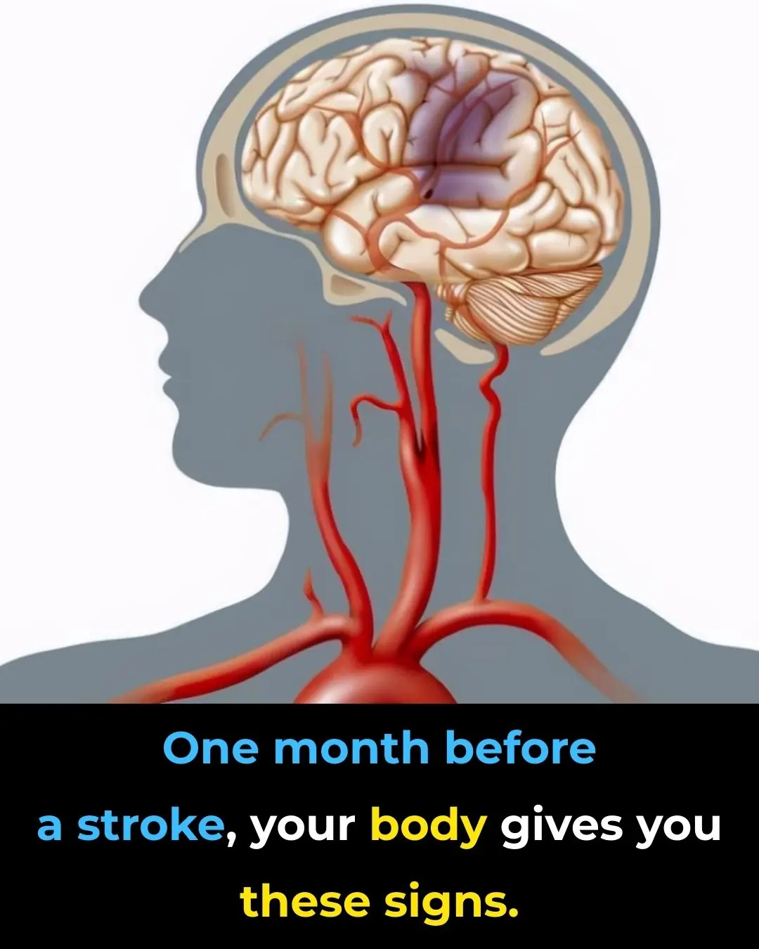 Sudden confusion or difficulty speaking: when it’s more than just fatigue
