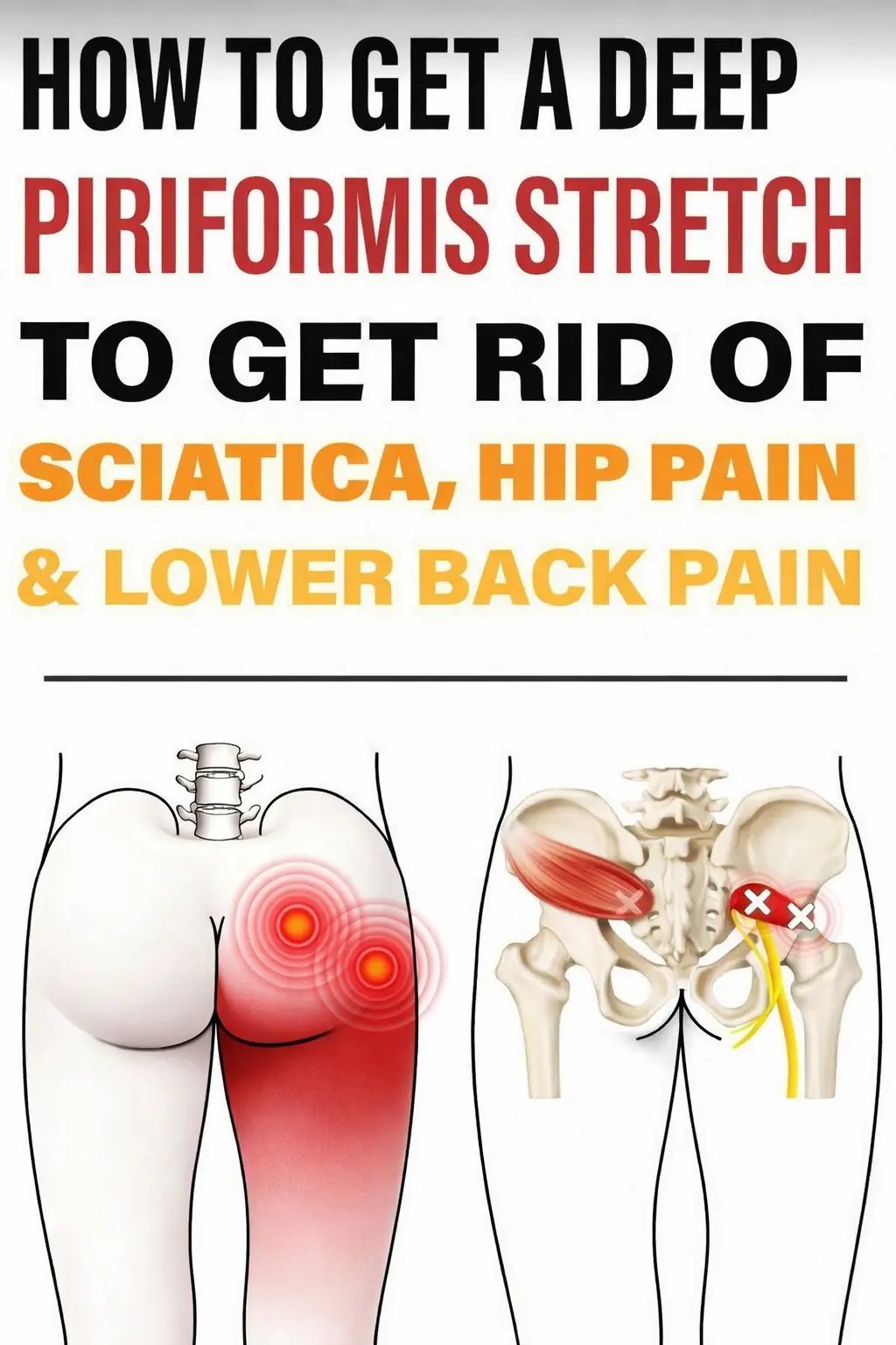 Powerful Piriformis Stretch to Soothe Sciatic, Hip, and Lower Back Pain