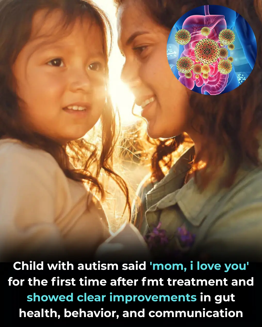 Fecal Microbiota Transplantation and Its Potential Role in Severe Autism Spectrum Disorder