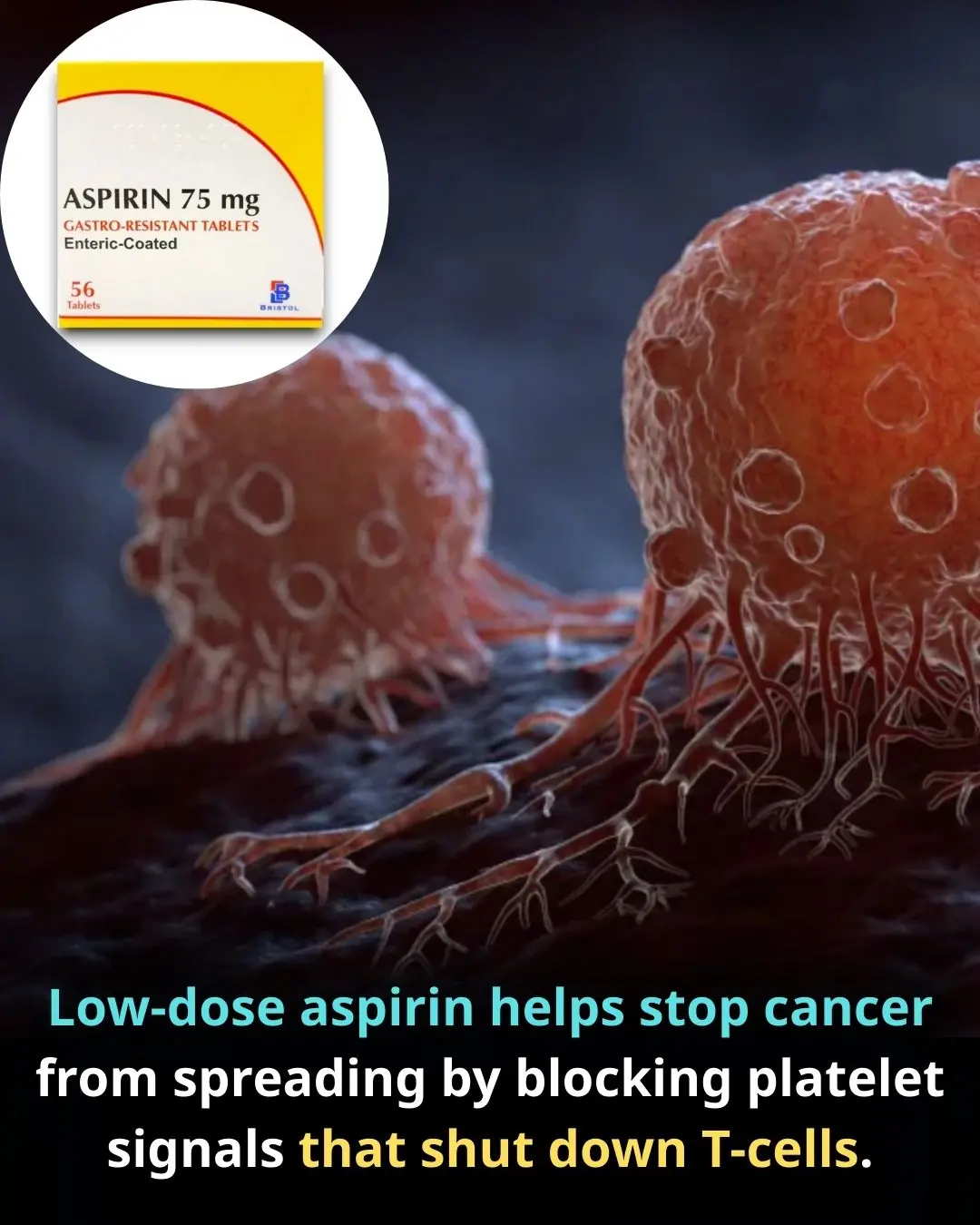 Aspirin as an Immune-Modulating Agent in the Suppression of Cancer Metastasis