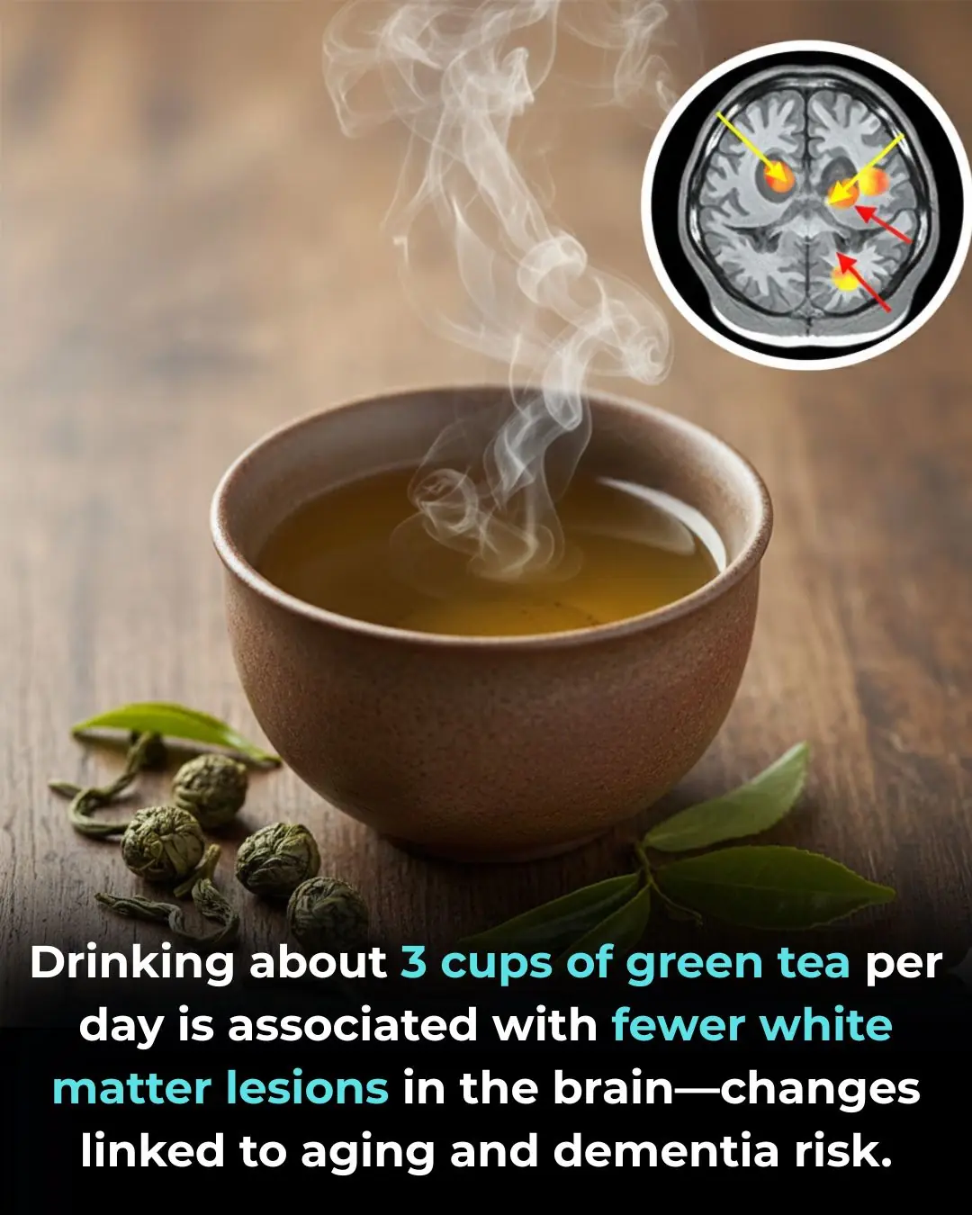 Drinking about 3 cups of green tea per day is associated with fewer white matter lesions in the brain—changes linked to aging and dementia risk