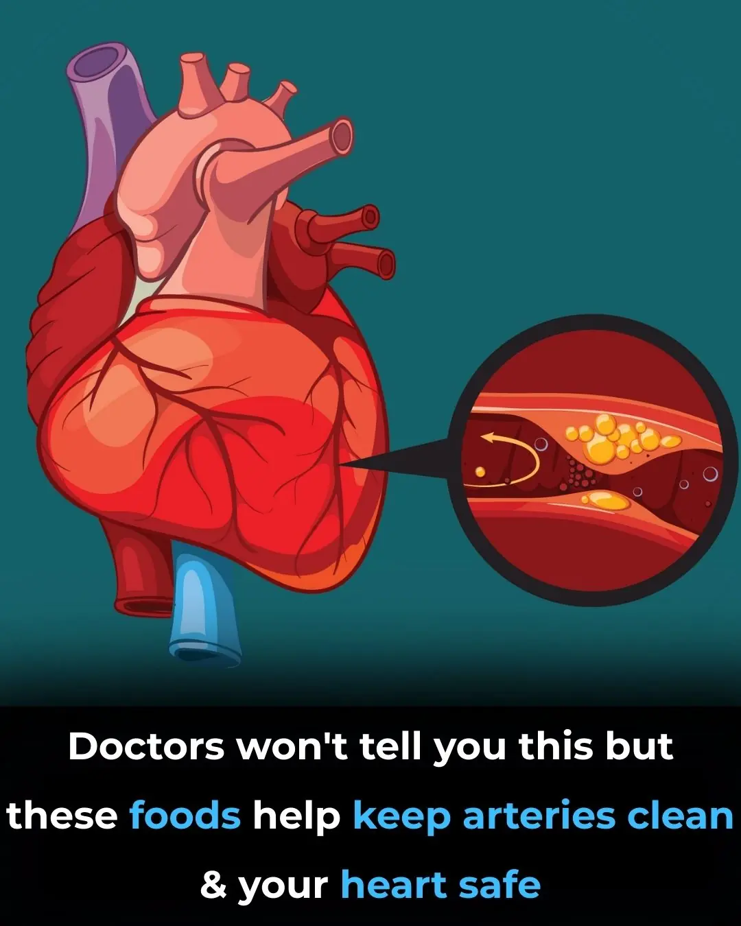 The Best Foods to Cleanse and Prevent Clogged Arteries