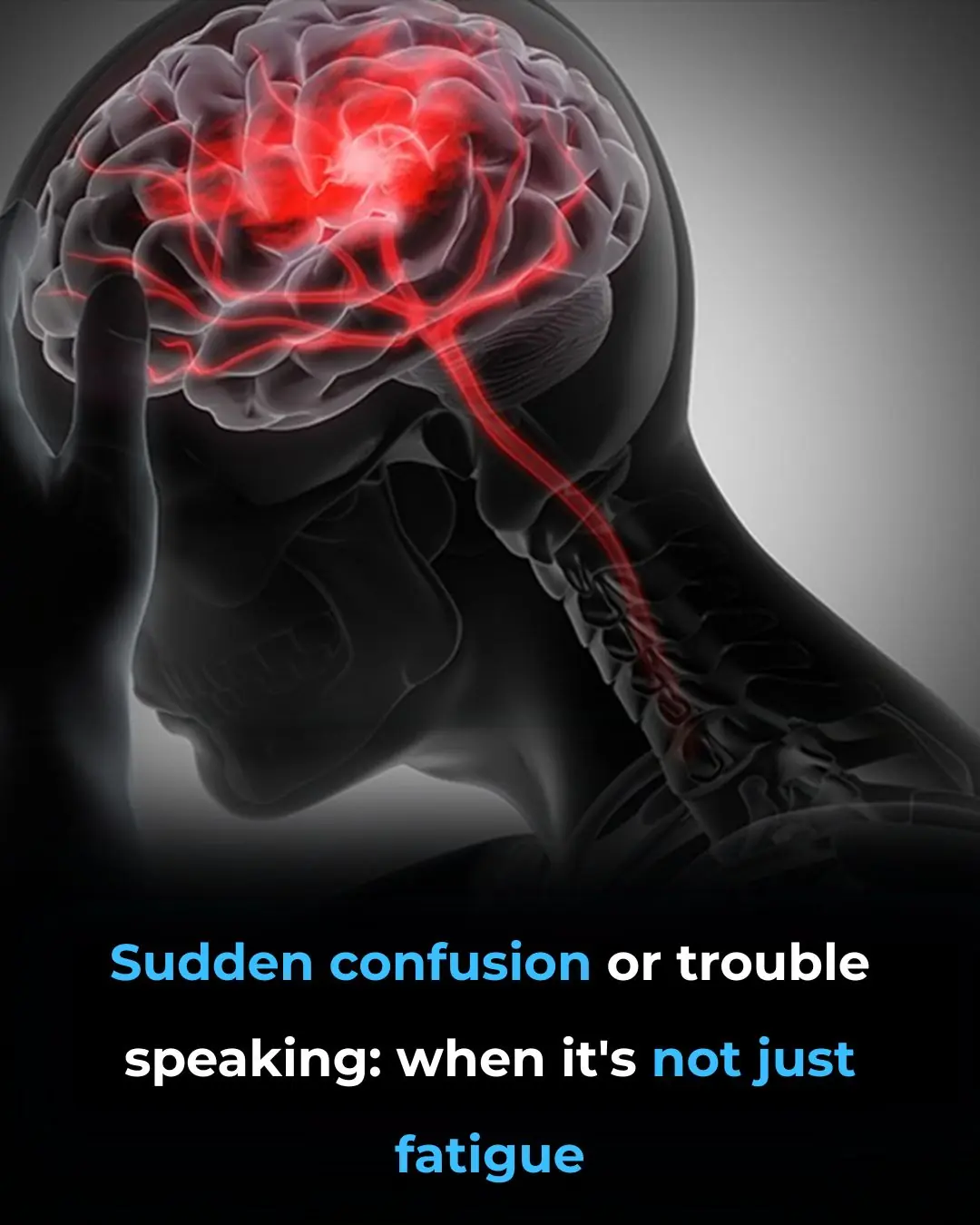 Sudden Confusion or Trouble Speaking: When It’s More Than Just Fatigue