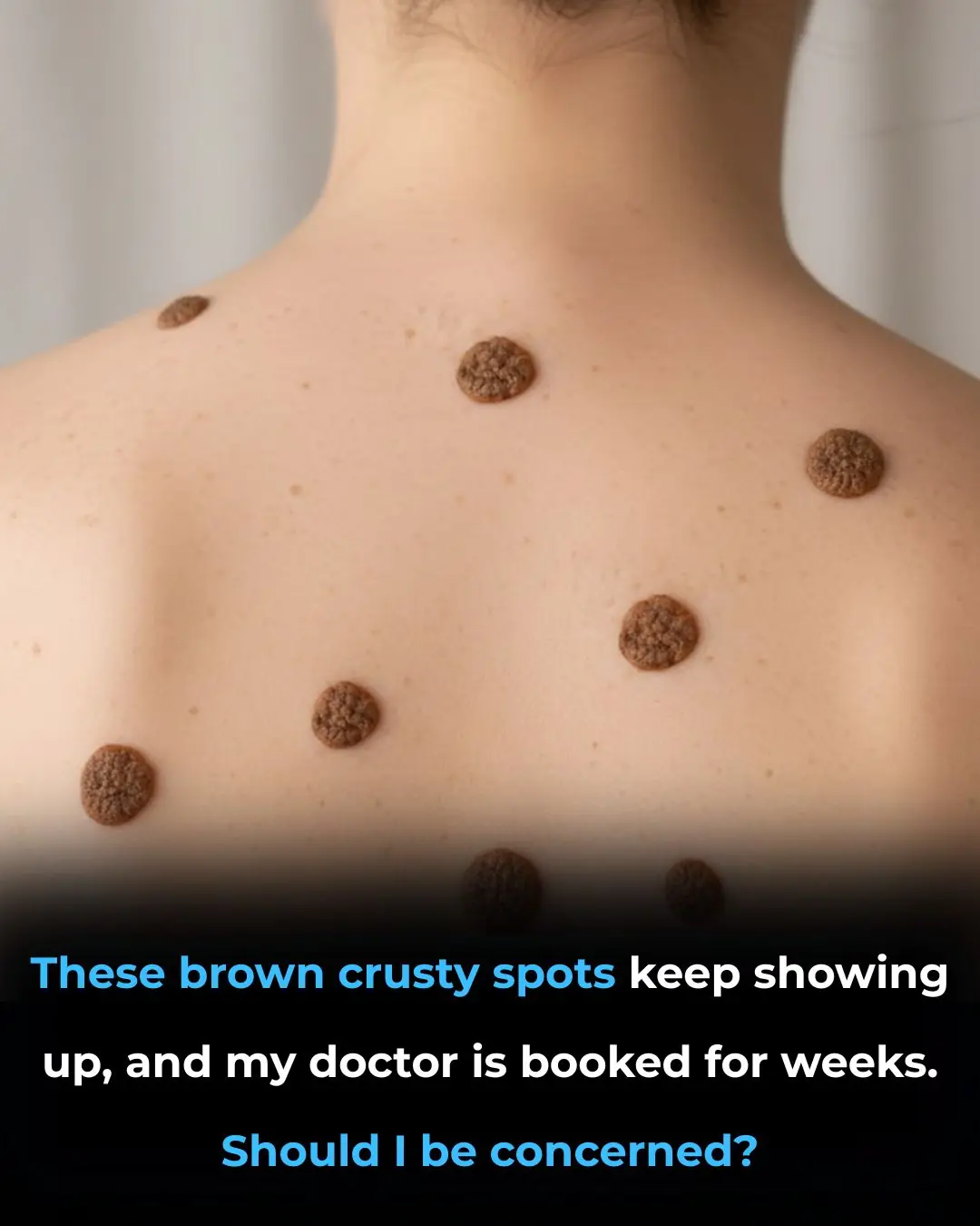 These brown crusty spots keep showing up, and my doctor is booked for weeks given Christmas. Should I be concerned?