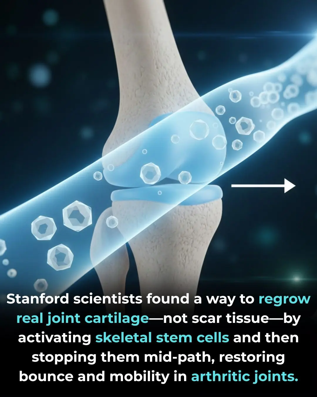 Regenerating True Articular Cartilage: A Breakthrough in Joint Repair