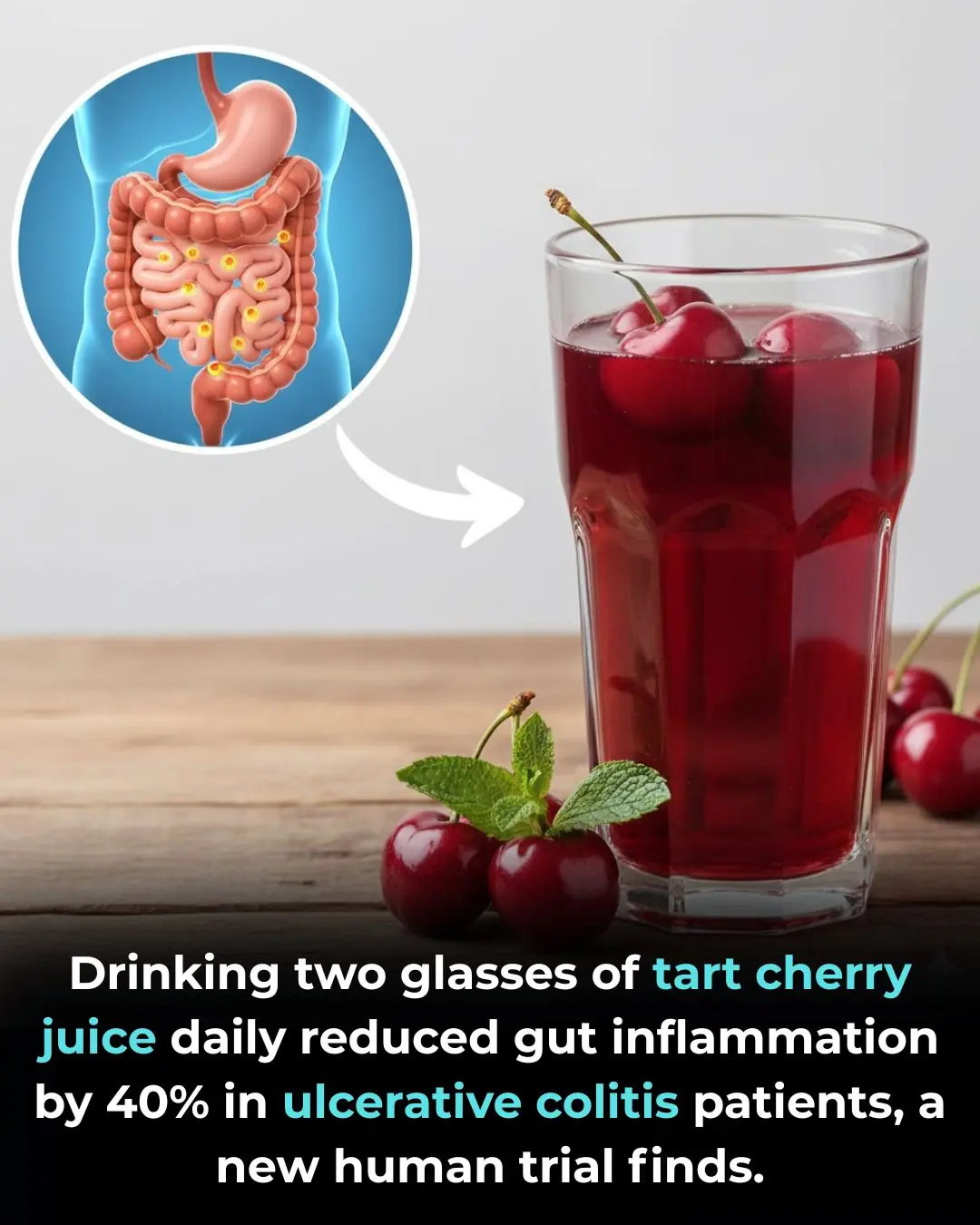 Montmorency Tart Cherry Juice as an Adjunctive Therapy in Ulcerative Colitis