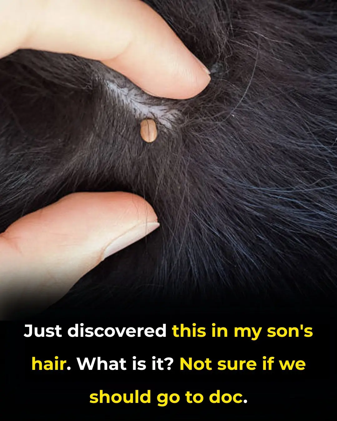 Just discovered this in my son's hair. What is it? Not sure if we should go to doc