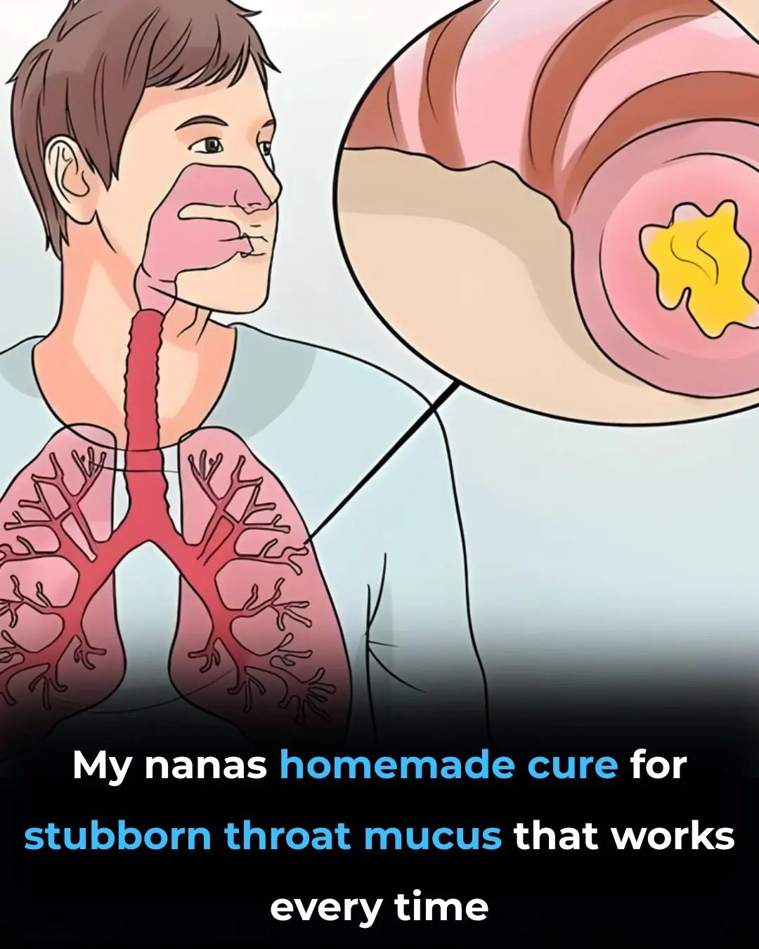 Get Rid of Throat Mucus Faster With These Home Treatments (Evidence Based)