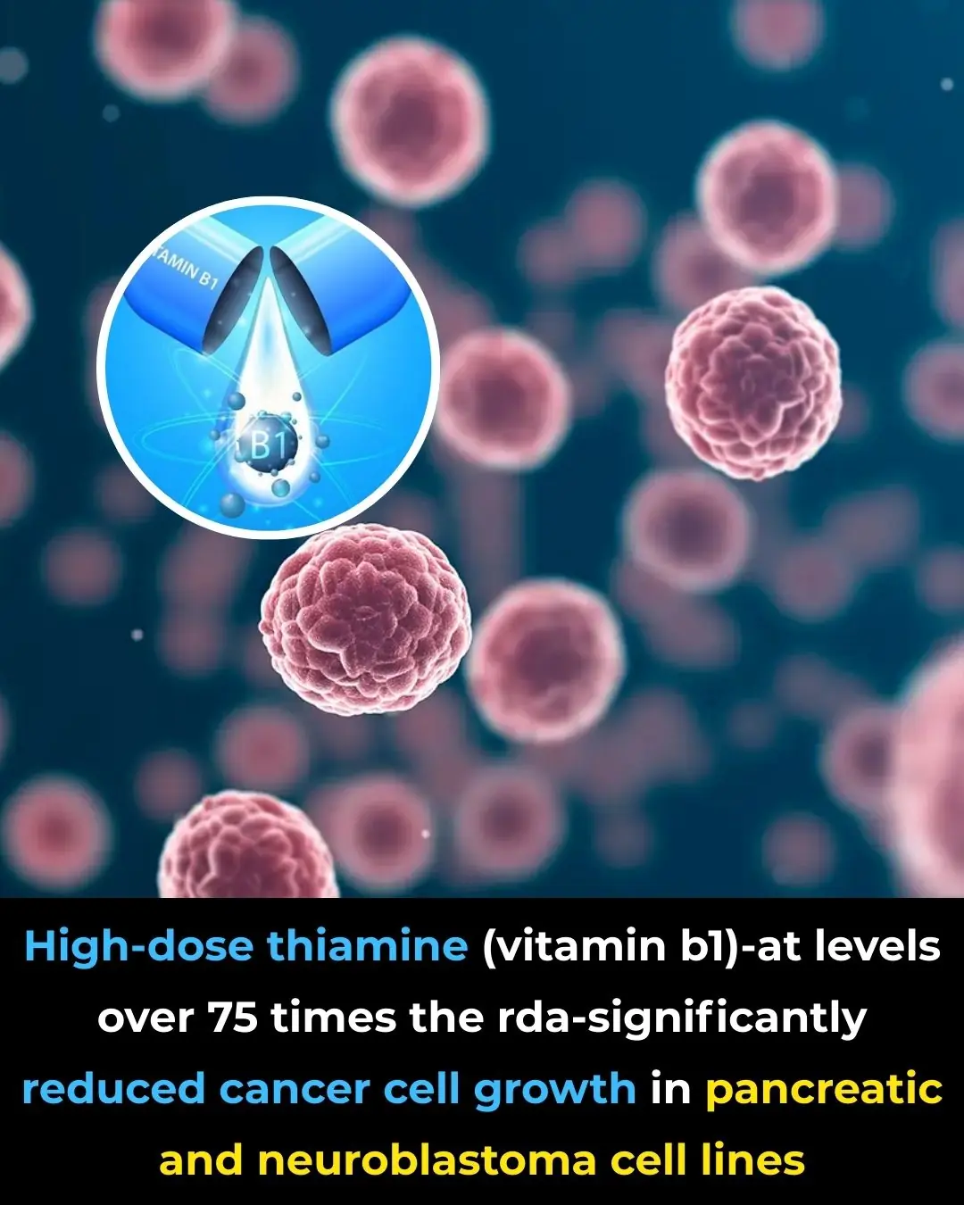 High-Dose Thiamine and Cancer Cell Metabolism: Evidence from Experimental Cell-Line Studies