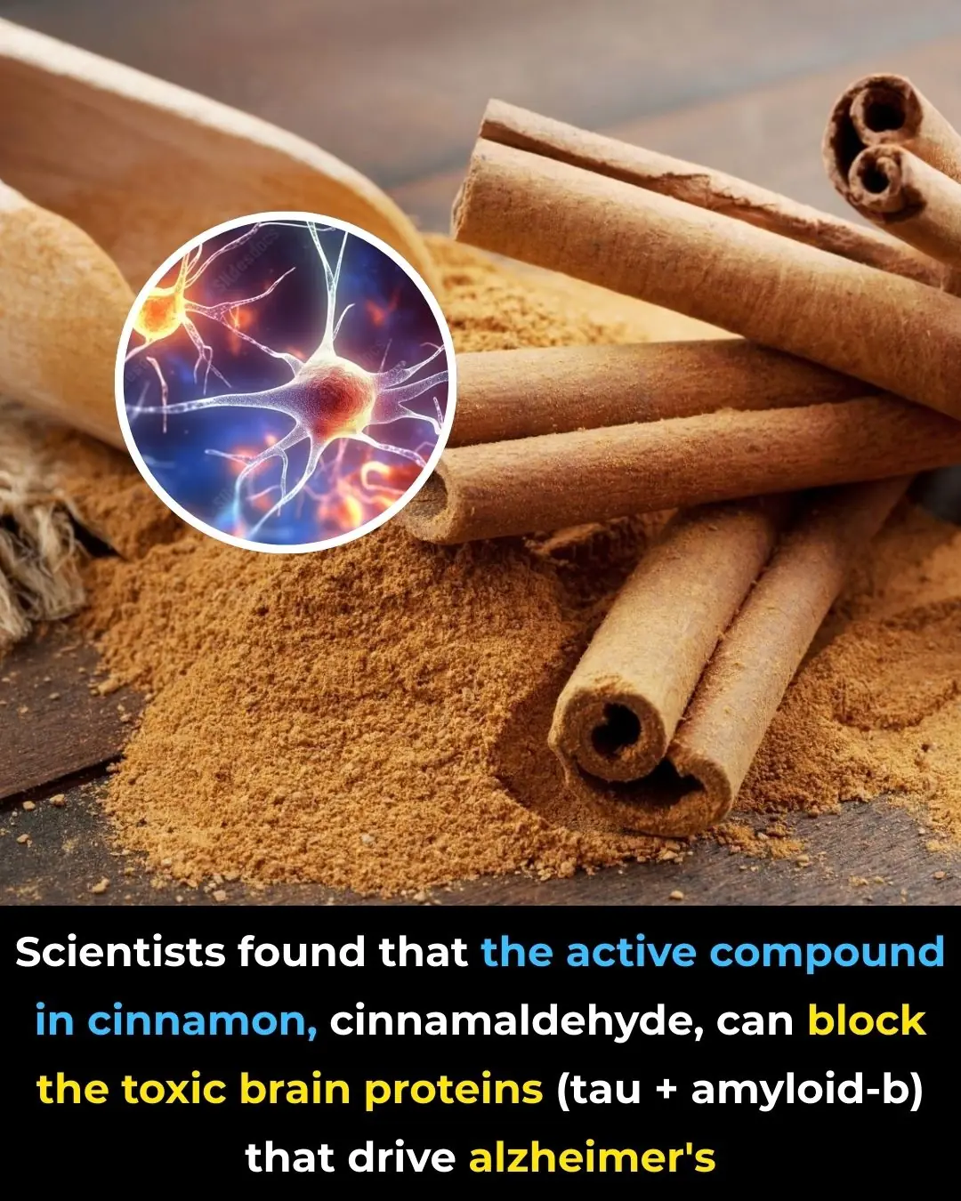Cinnamon and Neuroprotection: Evidence for Anti-Alzheimer’s Mechanisms