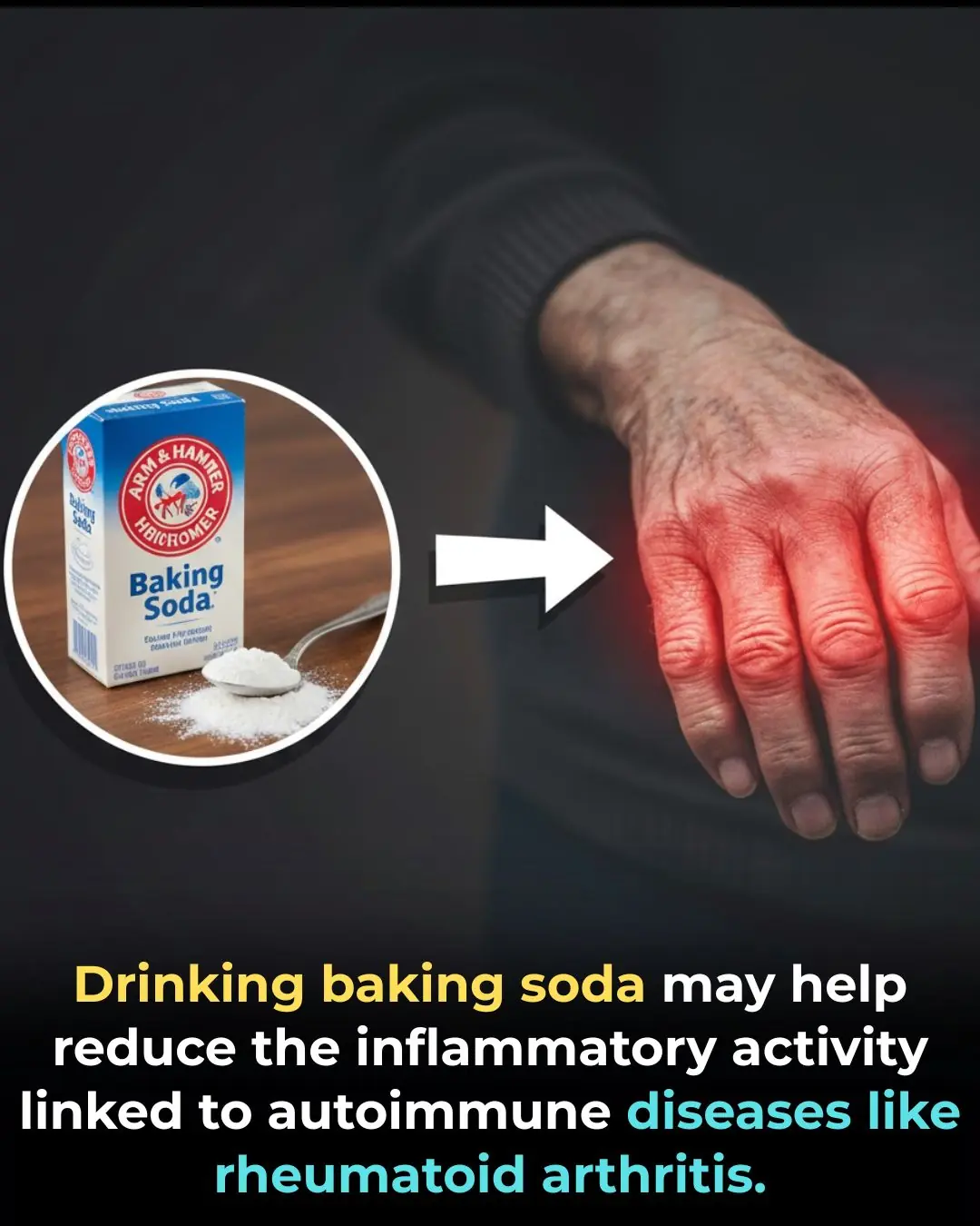 Sodium Bicarbonate and Immune Regulation: Evidence for an Anti-Inflammatory Mechanism