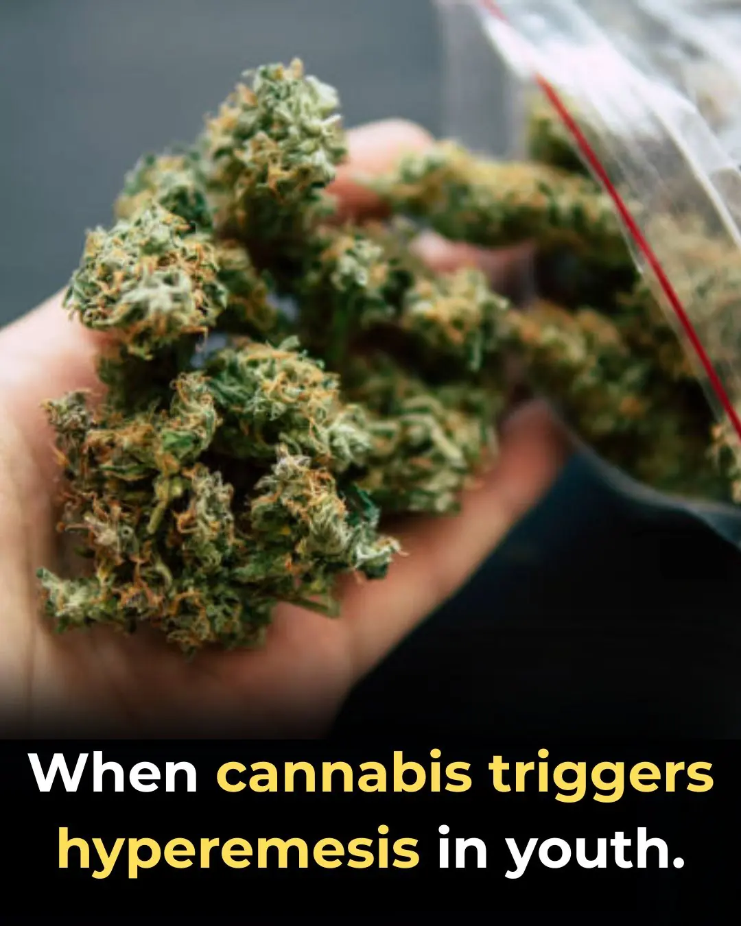 When Cannabis Triggers Hyperemesis in Youth: Understanding a Growing Emergency
