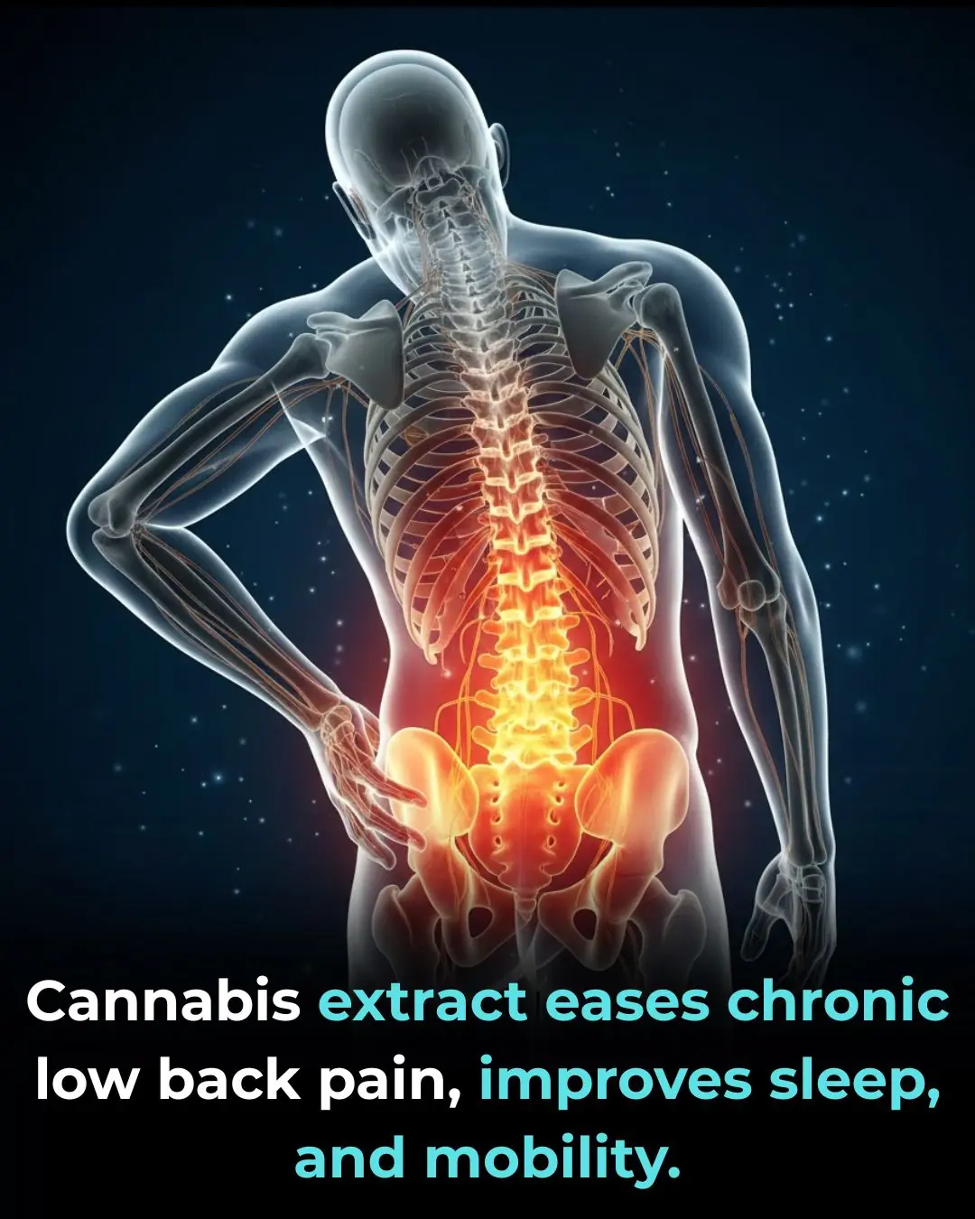 Cannabis Extract Eases Chronic Low Back Pain and Improves Sleep and Mobility: Promising Phase 3 Evidence