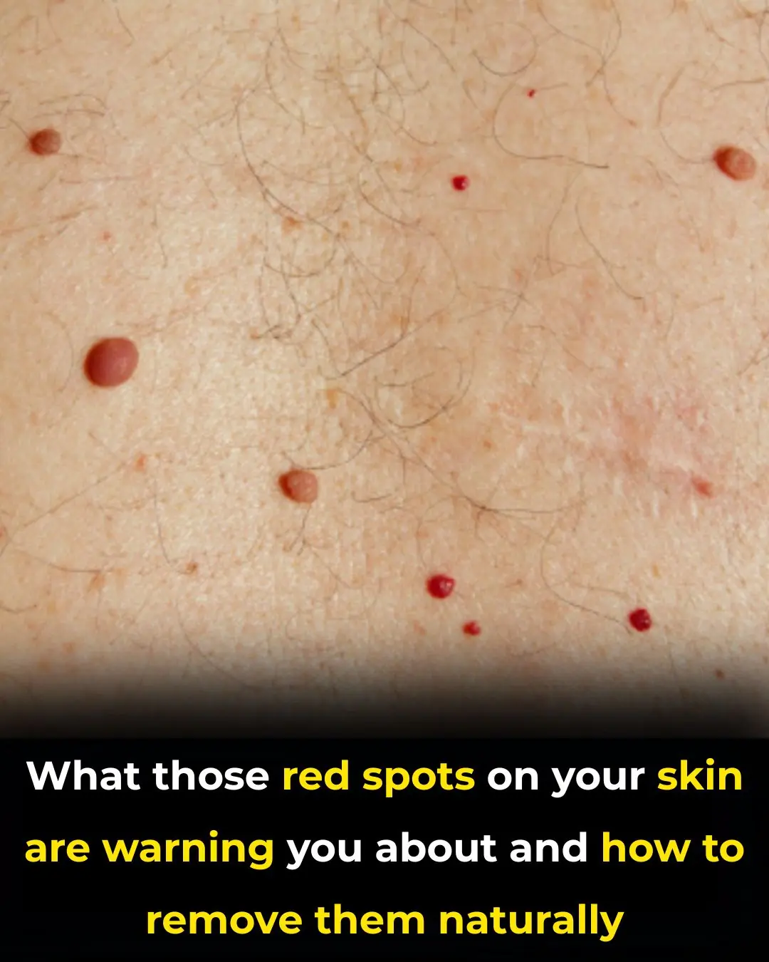 Red Spots on Skin: Causes, Treatments and More (Extensive Guide)
