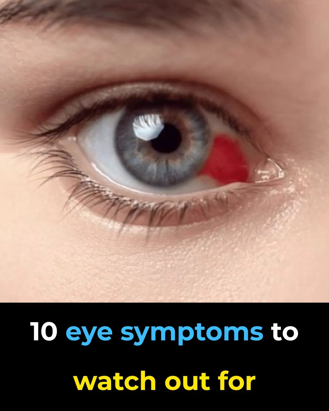10 Eye Symptoms to Watch Out For