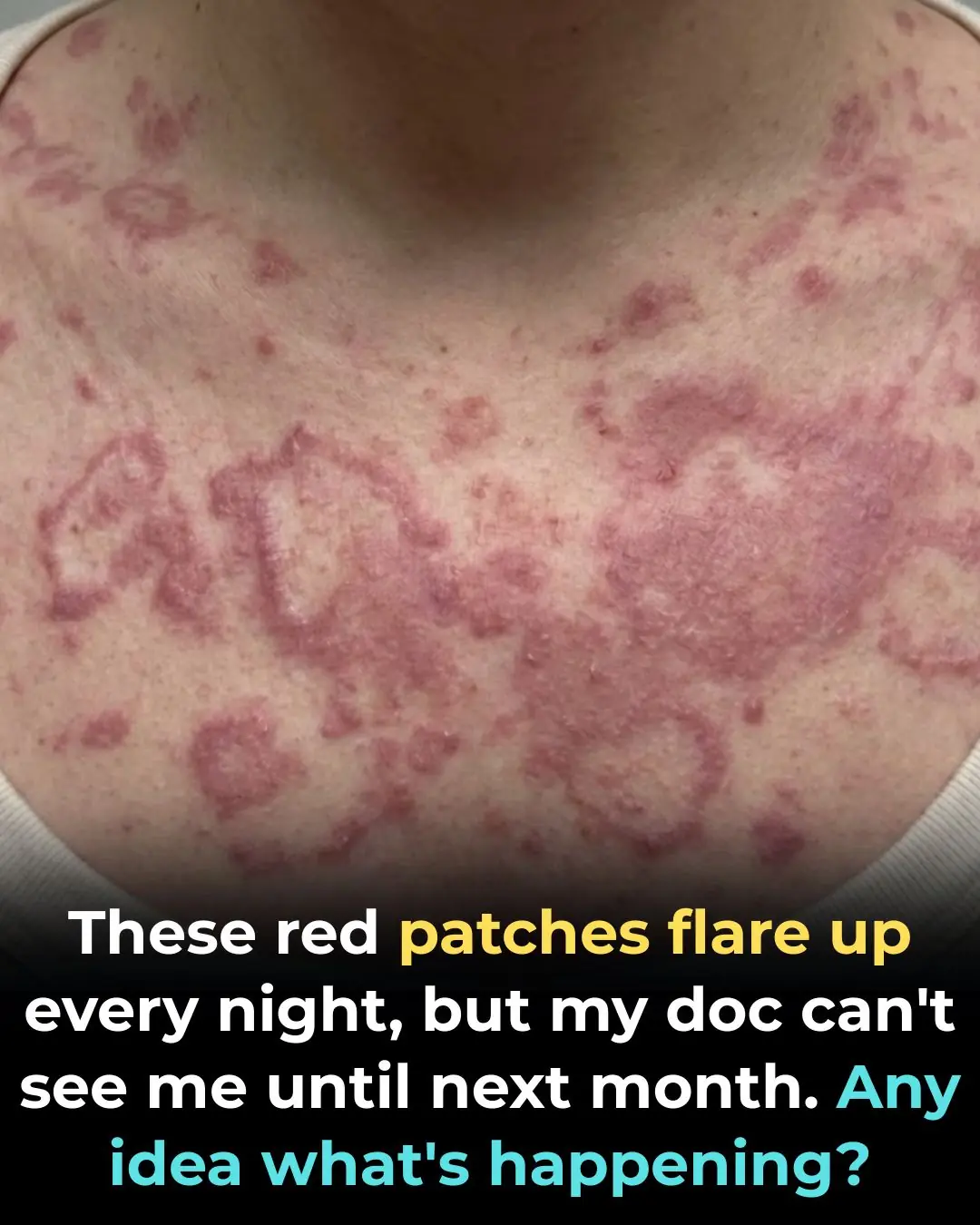 These red patches flare up every night, but my doc can’t see me until next month. Any idea what’s happening?