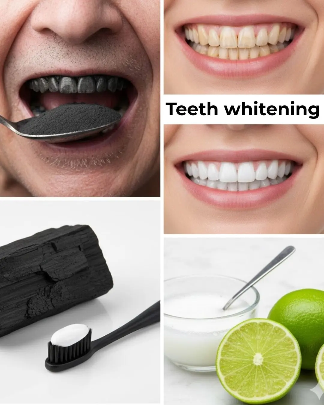 Teeth Whitening – Natural Home Remedies