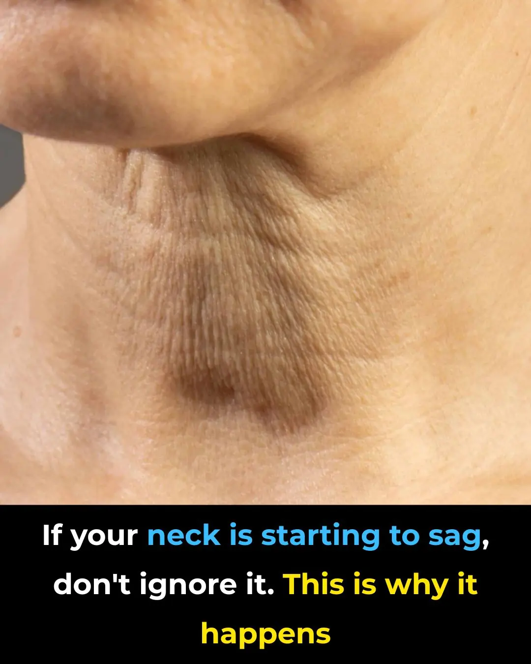 If your neck is starting to sag, don’t ignore it. This is why it happens