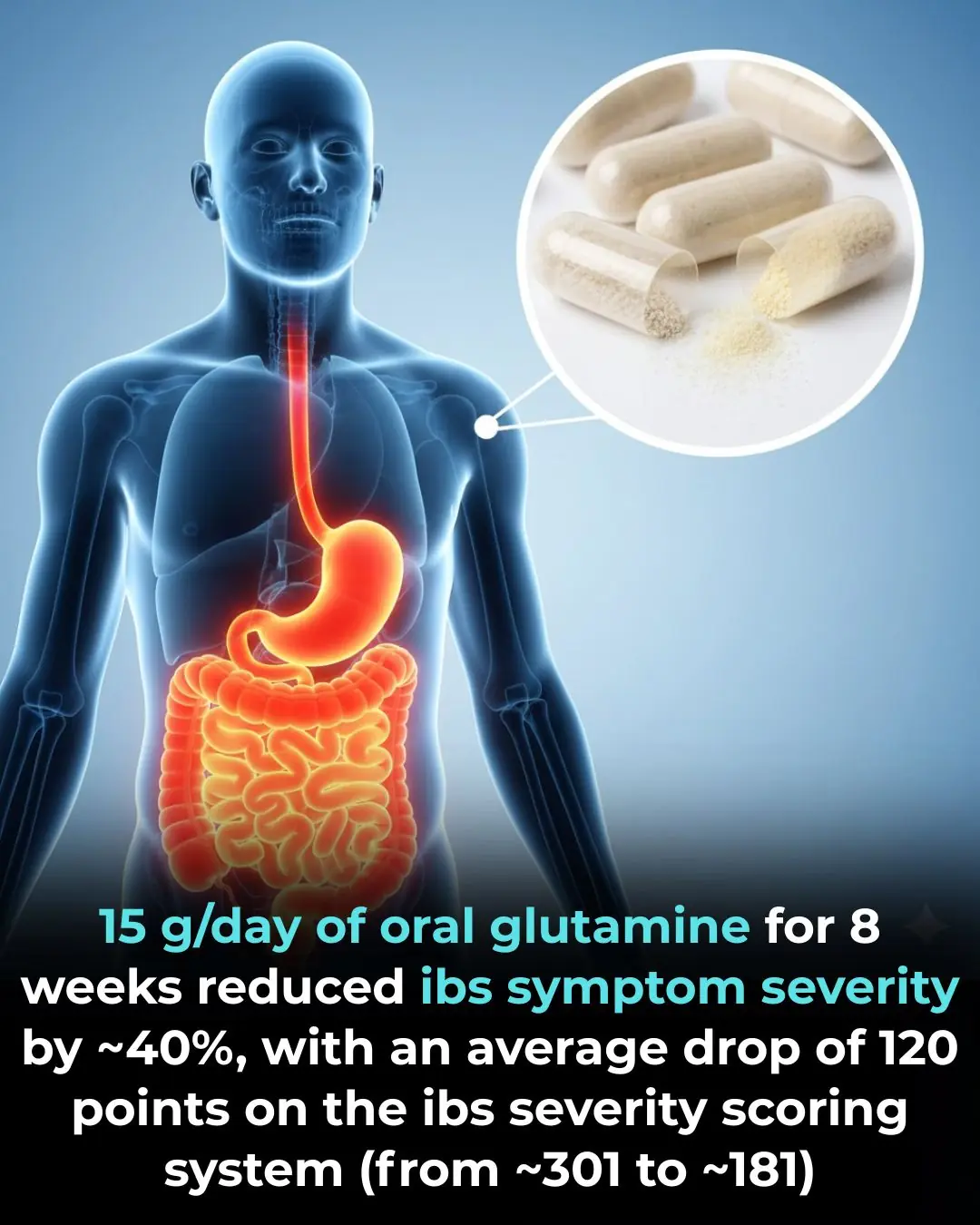 The Therapeutic Role of Glutamine in Post-Infectious Irritable Bowel Syndrome