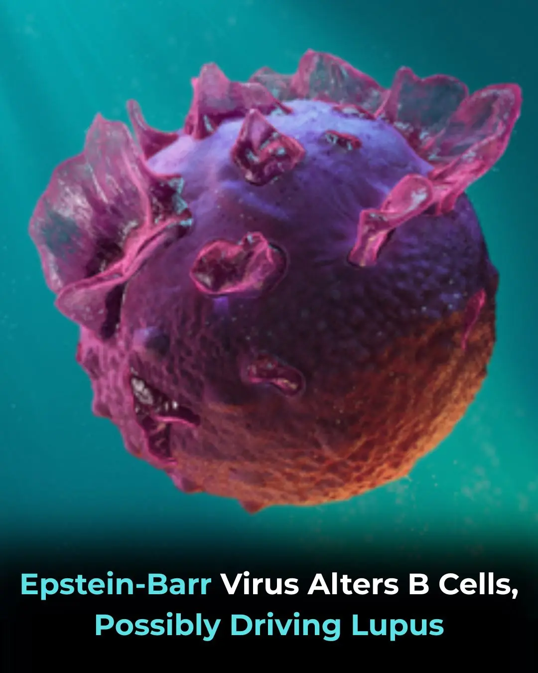 Epstein–Barr Virus May Reprogram B Cells and Drive Autoimmunity in Lupus