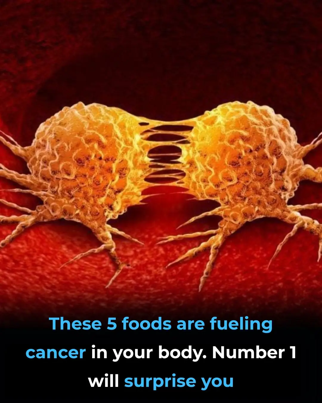 Why Hot Dogs and Processed Meat Might Be the Most Dangerous Foods of All Time