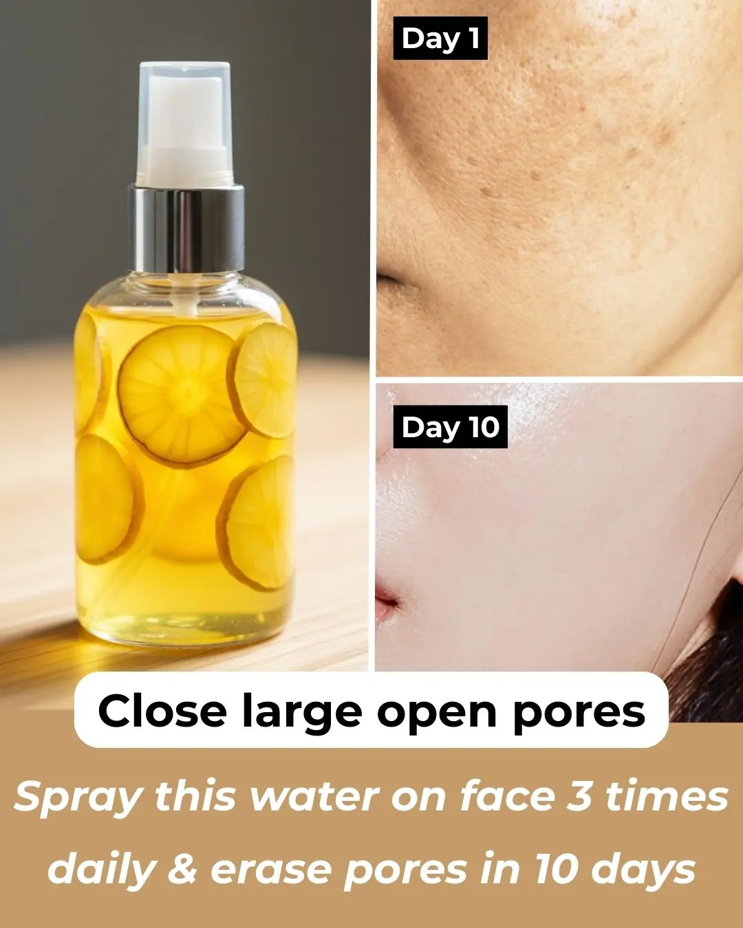 Potato Toner for Face – Dark Spots, Clear Skin & Pigmentation