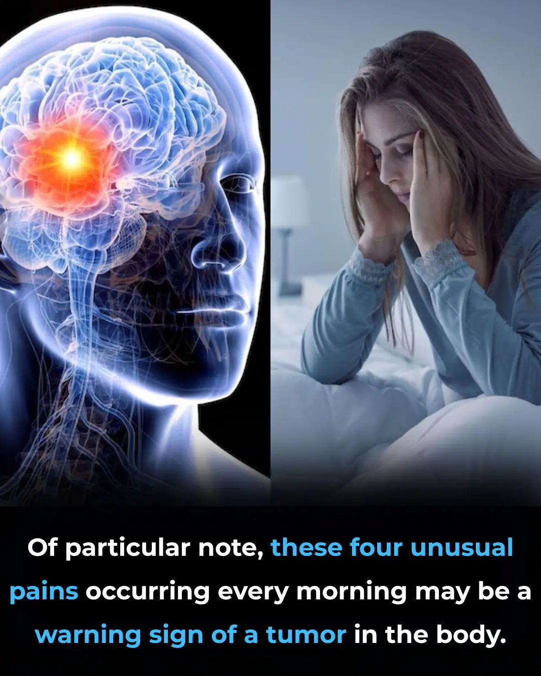 Of particular note, these four unusual pains occurring every morning may be a warning sign of a tumor in the body