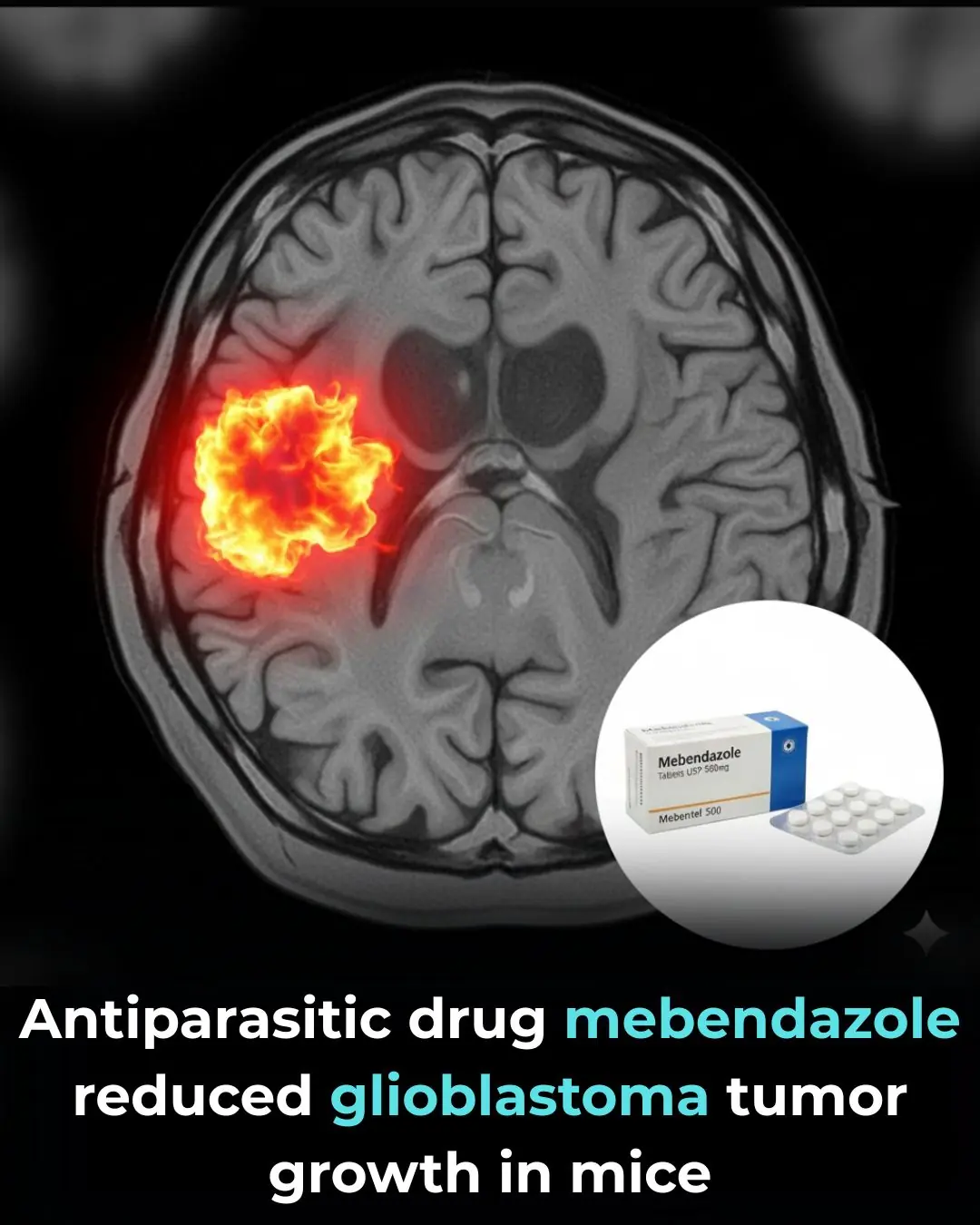 Mebendazole as a Repurposed Therapy for Glioblastoma: Evidence from Preclinical Research