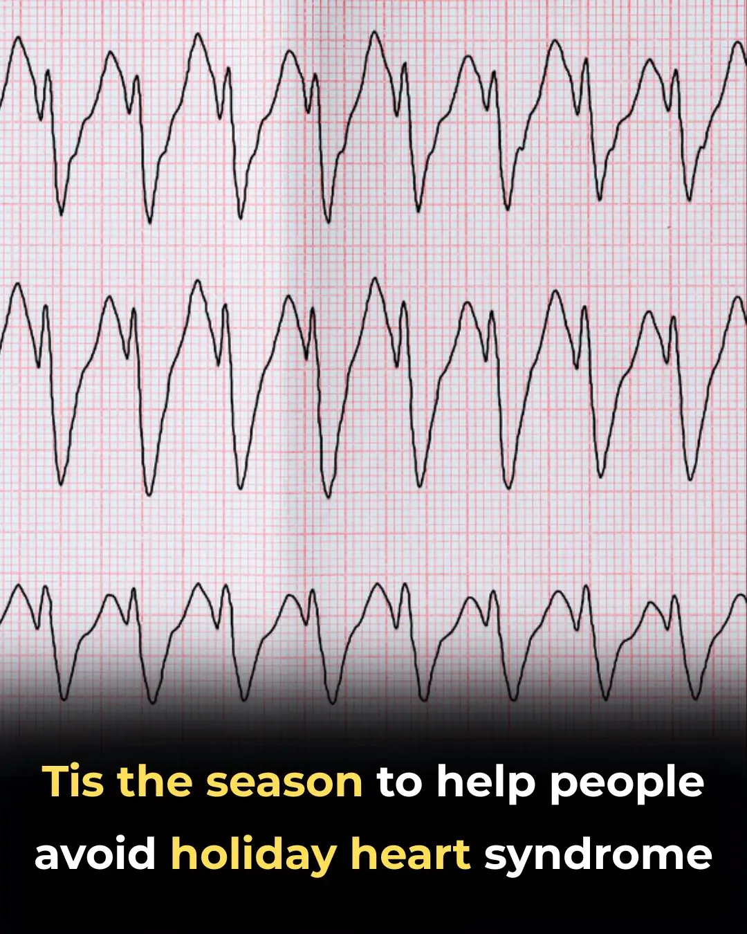 ‘Tis the Season to Help People Avoid Holiday Heart Syndrome
