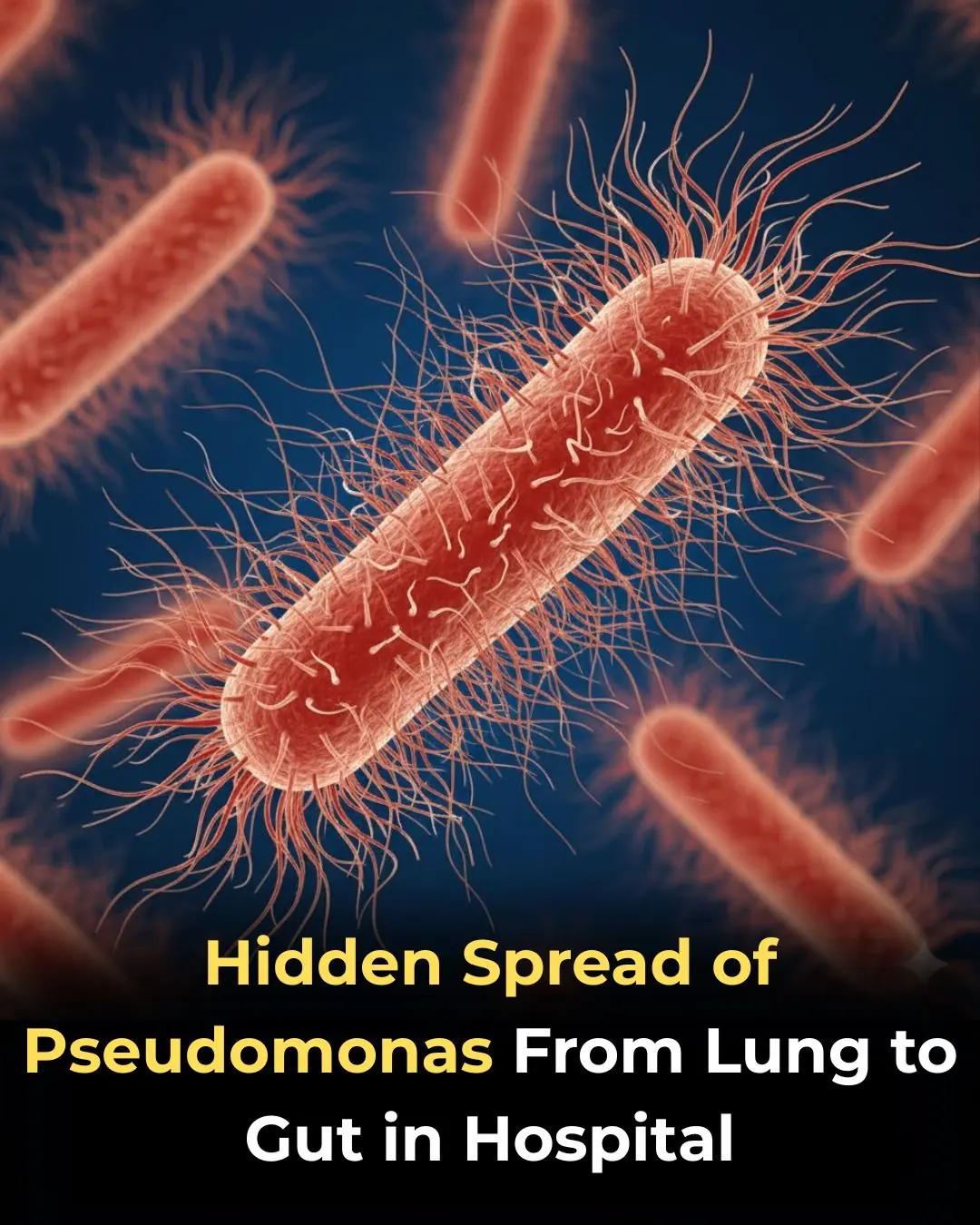 Hidden Spread of Pseudomonas aeruginosa From Lung to Gut in Hospitalized Patients