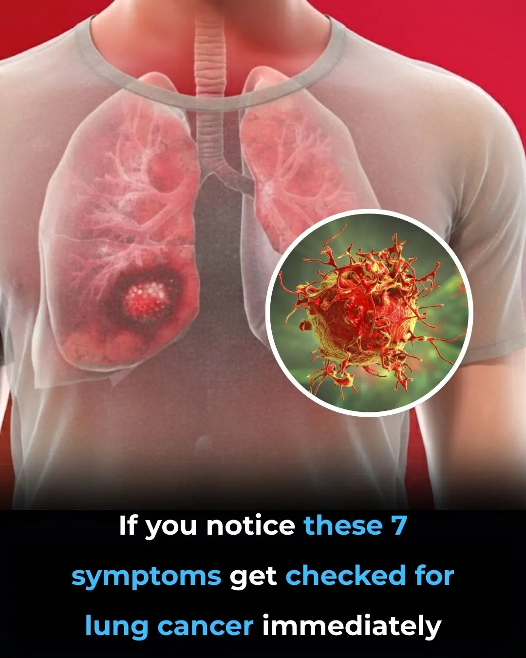 7 Warning Signs of Lung Cancer You Shouldn’t Ignore