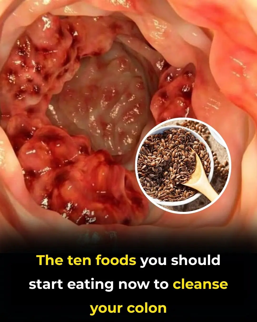 Colon Cleansing: How to Naturally Flush Your Colon at Home (Science Based)