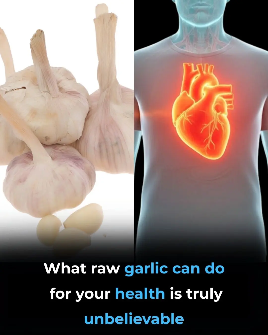 Medicinal Health Benefits of Garlic (Raw, Supplement) – Science Based