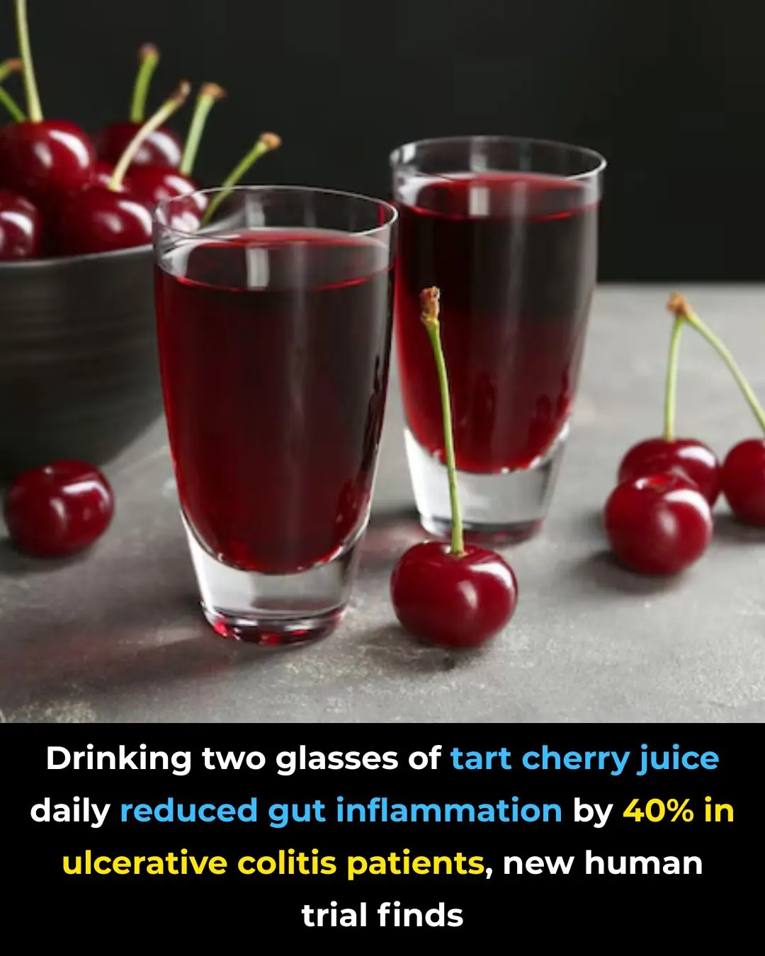 Montmorency Tart Cherry Juice as a Supportive Dietary Intervention in Ulcerative Colitis